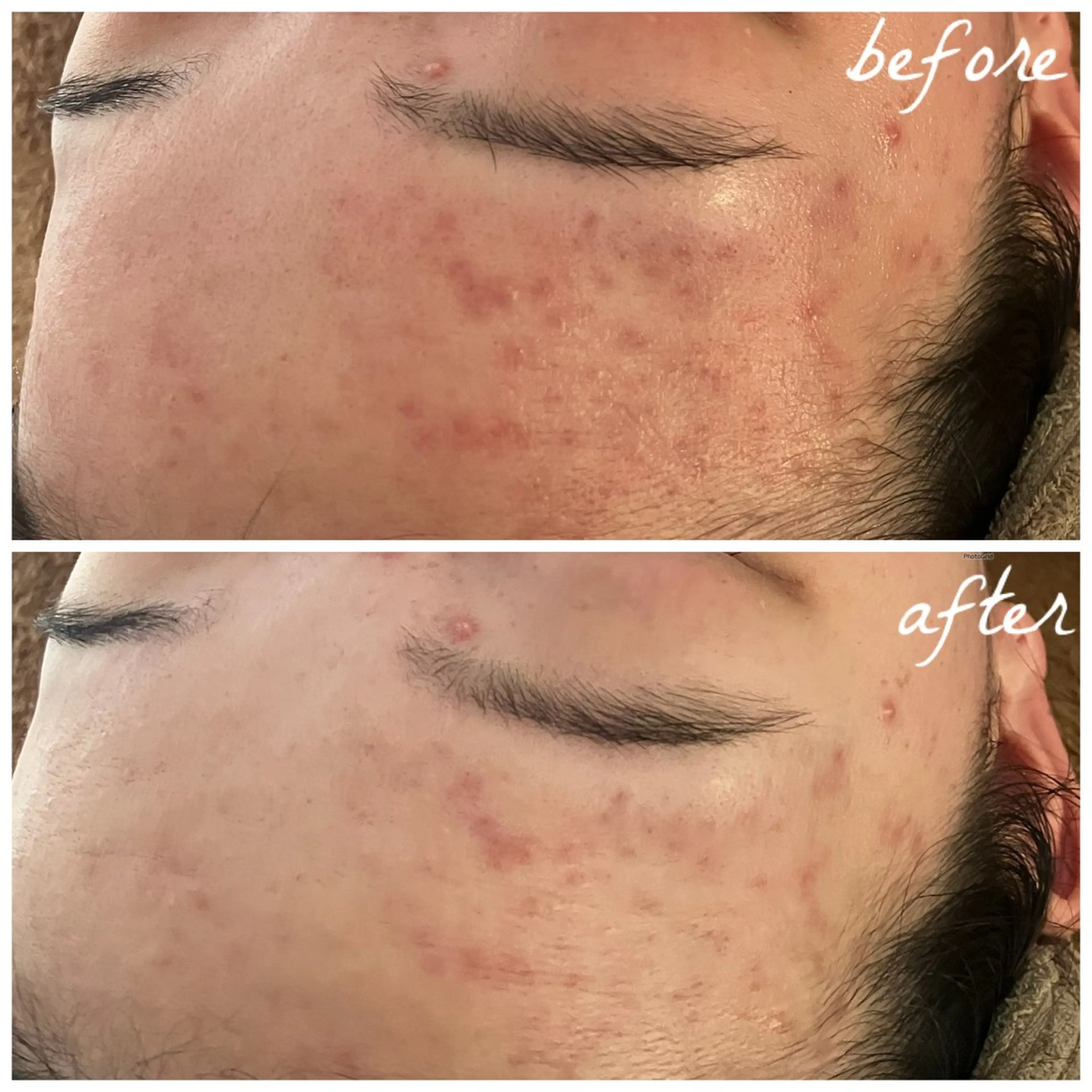 メンズ エステ メナード岐阜市茜部 杉浦のエステ・リラクイメージ