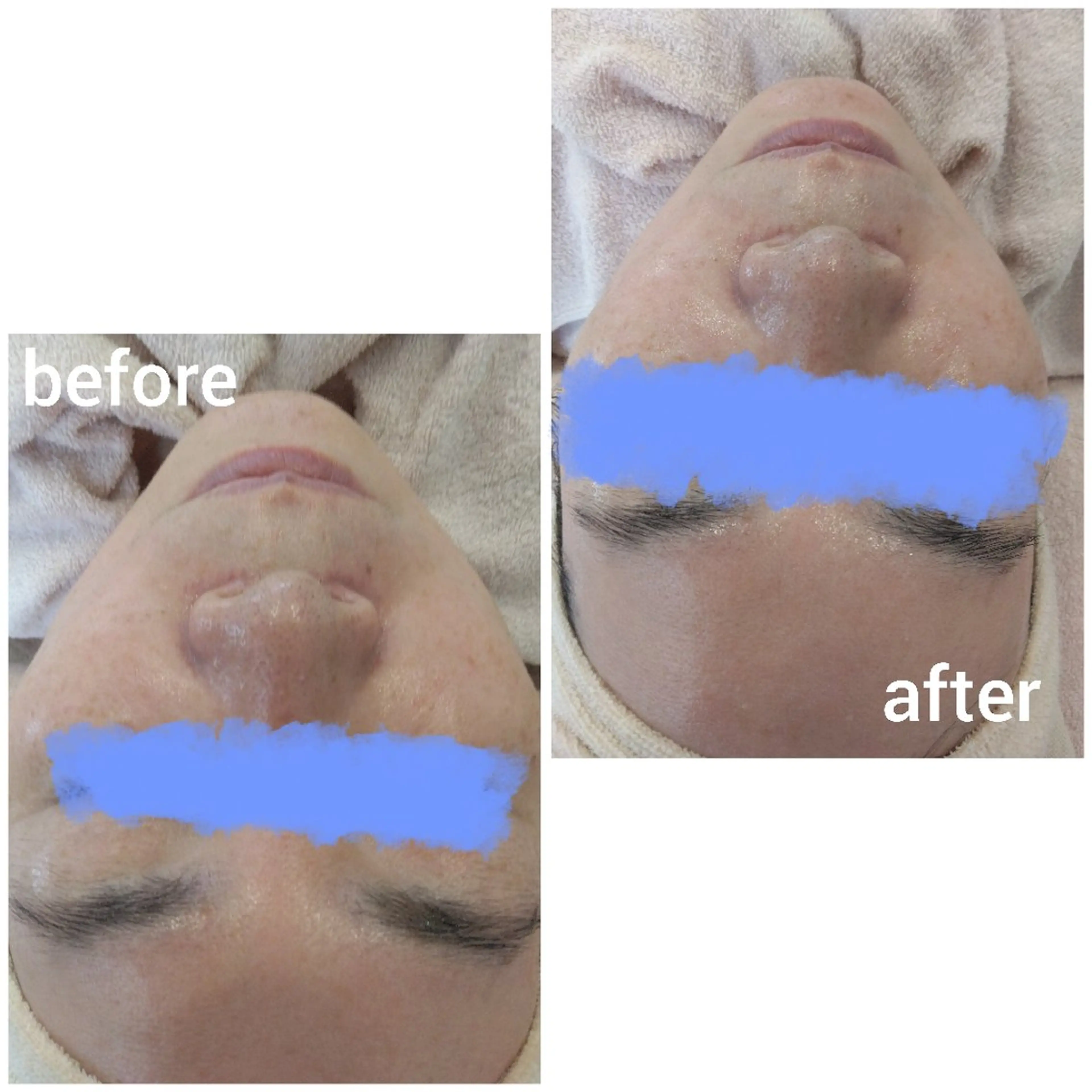 エステ フェイシャルエステ ZELOSSALONのエステ・リラクイメージ