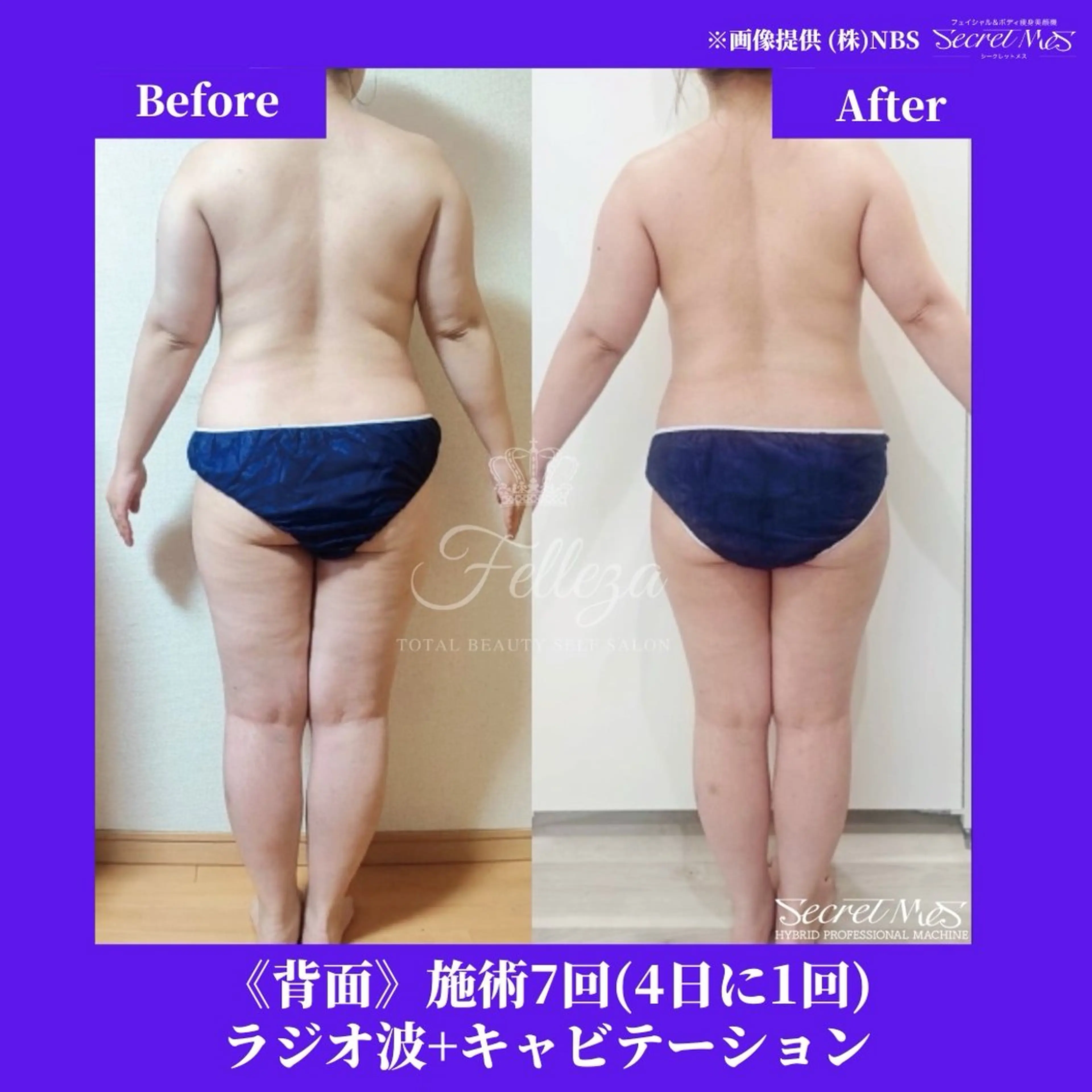 メンズ 有人型セルフサロン 脱毛／痩身／美顔のその他イメージ