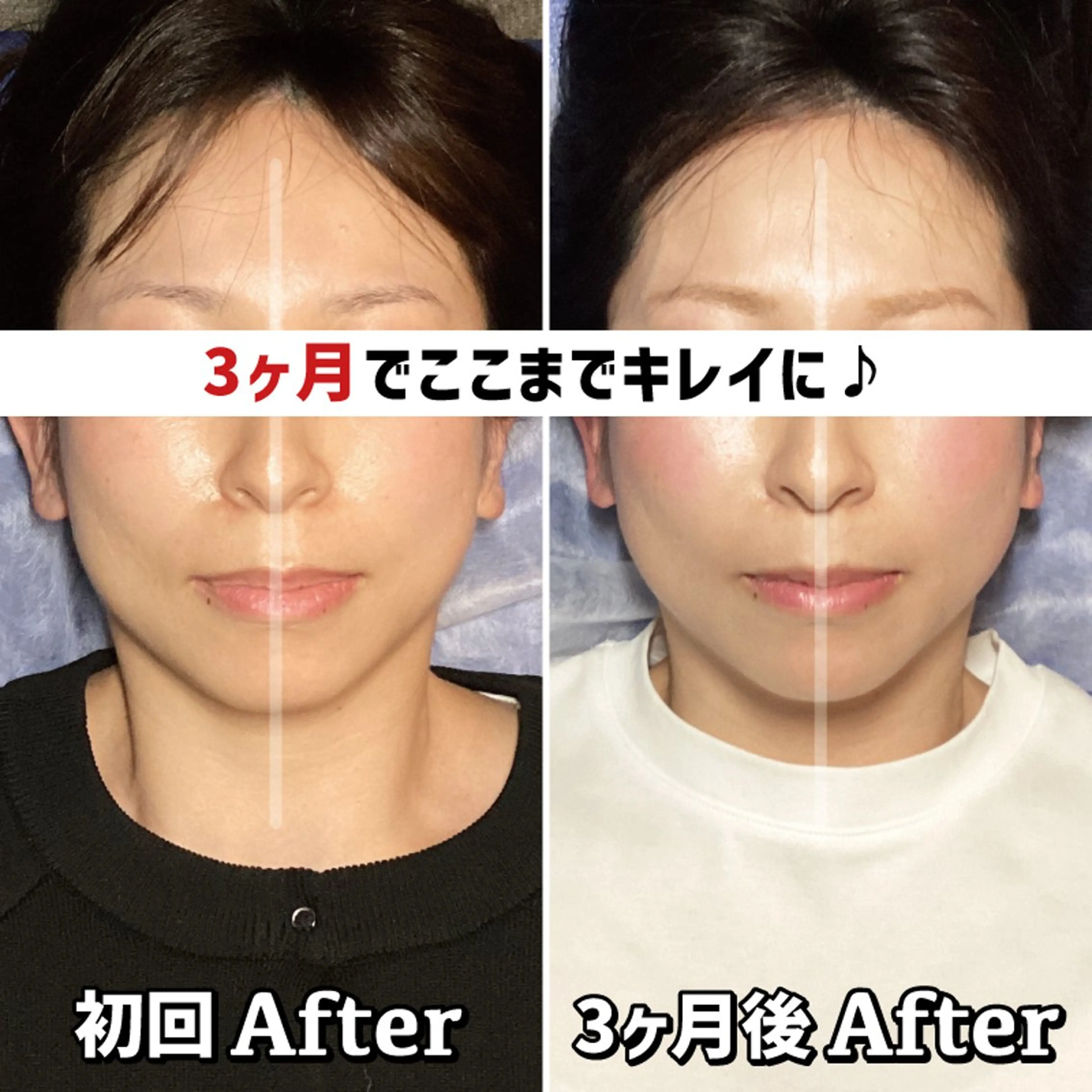 エステ リラク 歪み専門💫筋膜整体 はたやまきんま君💪のエステ・リラクイメージ