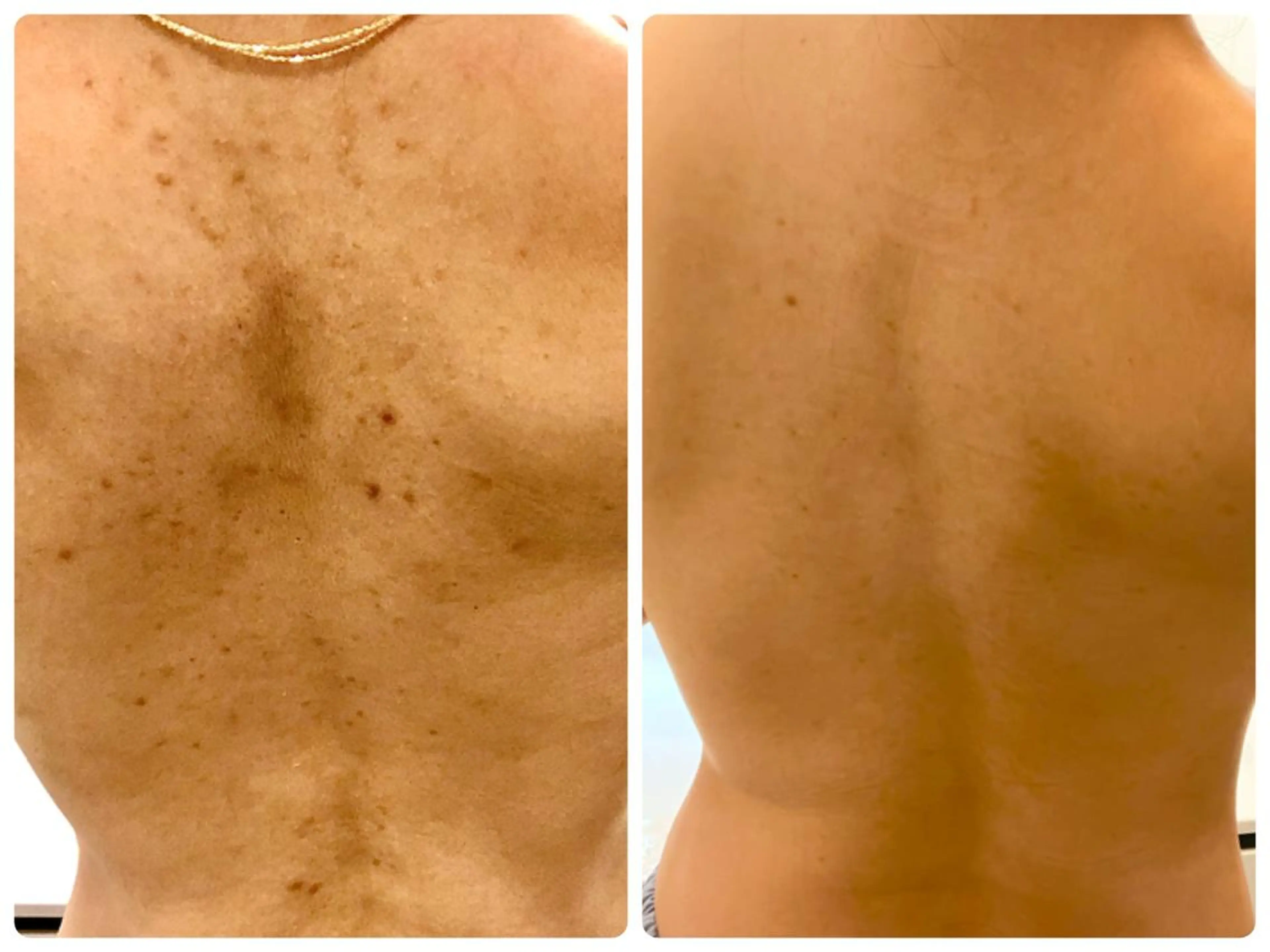 エステ フェイシャル専門 肌質改善/プランスのエステ・リラクイメージ