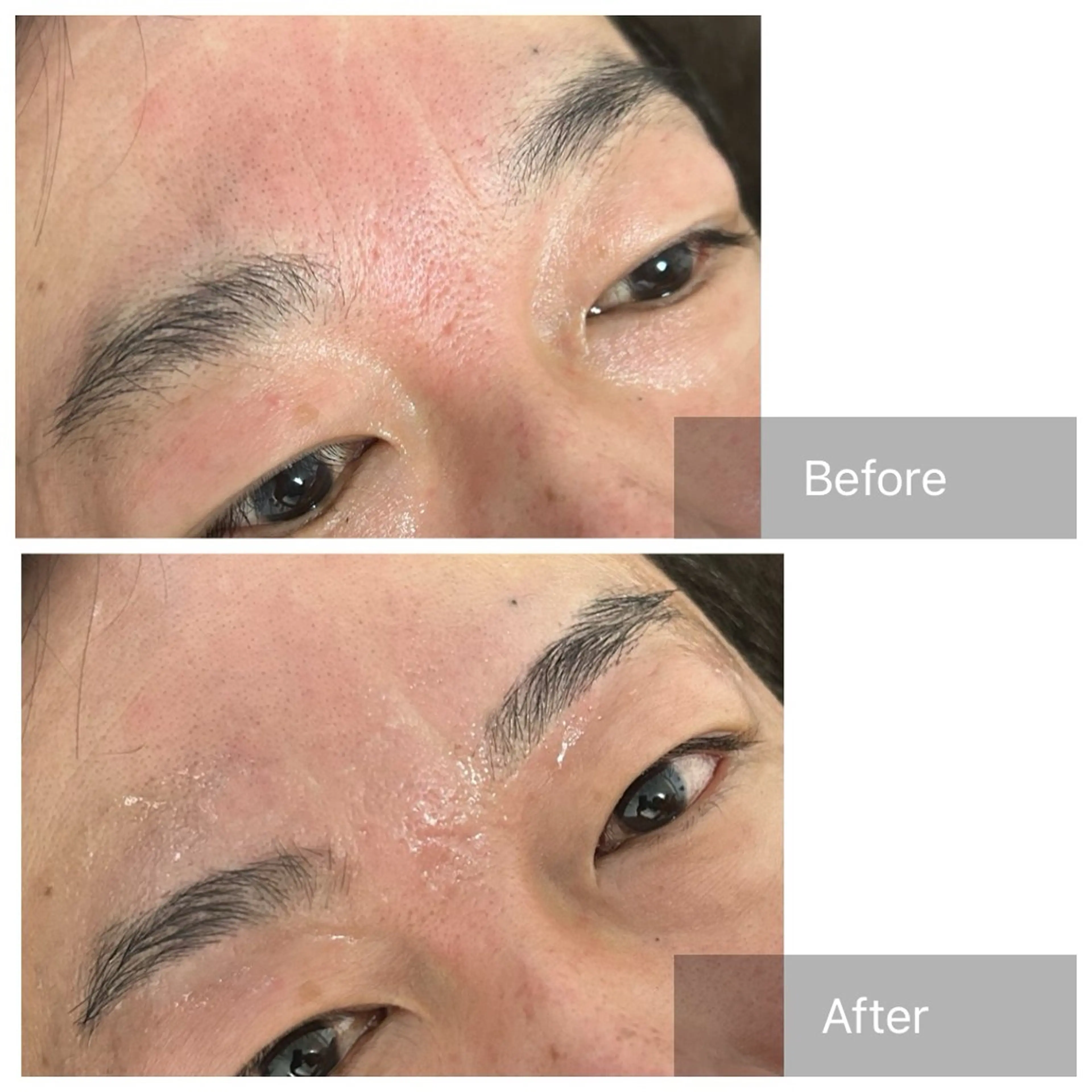 メンズ アイブロウ 眉毛ワックス脱毛 ワックス脱毛 エマニエル USAのエステ・リラクイメージ