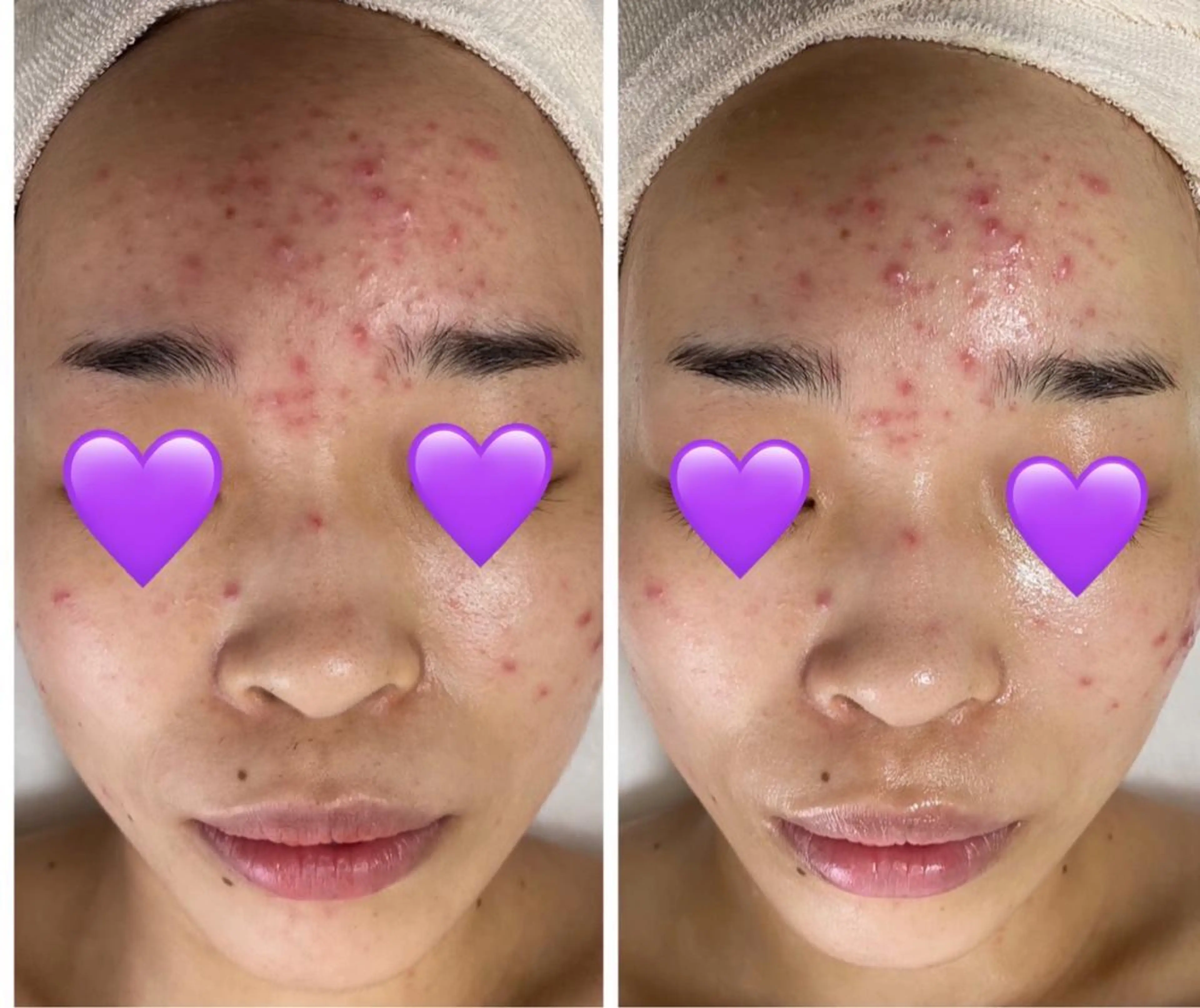 エステ De I'm トータルビューティーサロン所属・COCO beautyサロンのエステ・リラクイメージ