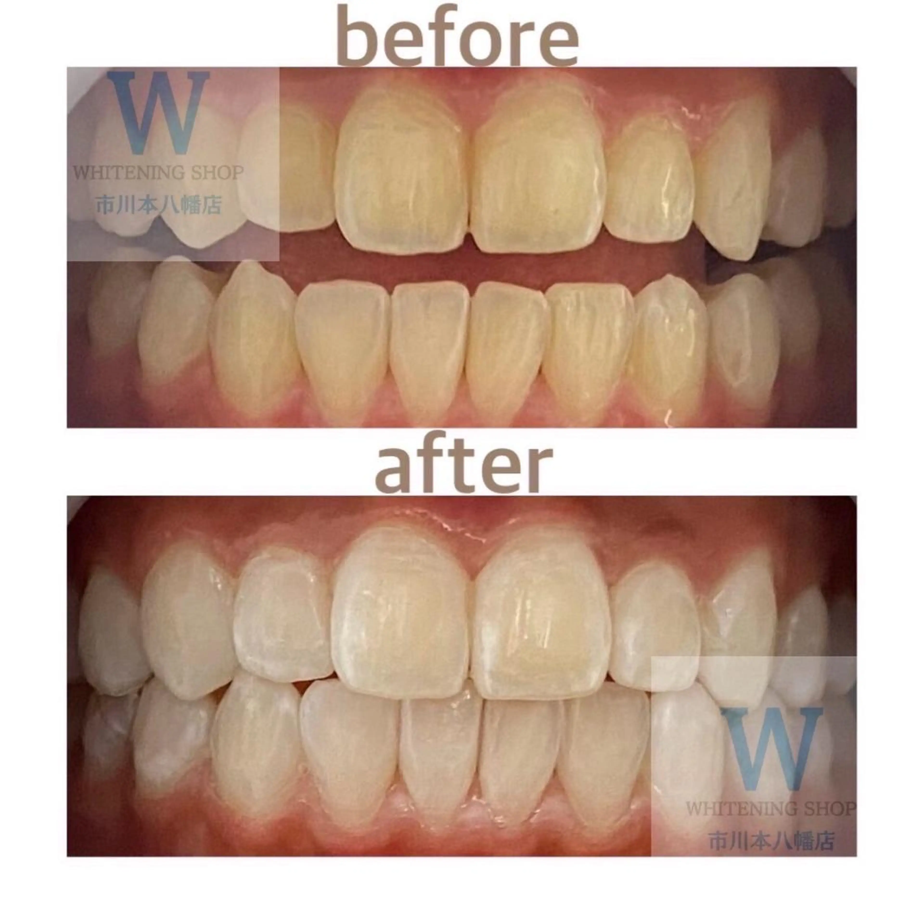 ホワイトニング ショップ本八幡店のエステ・リラクイメージ