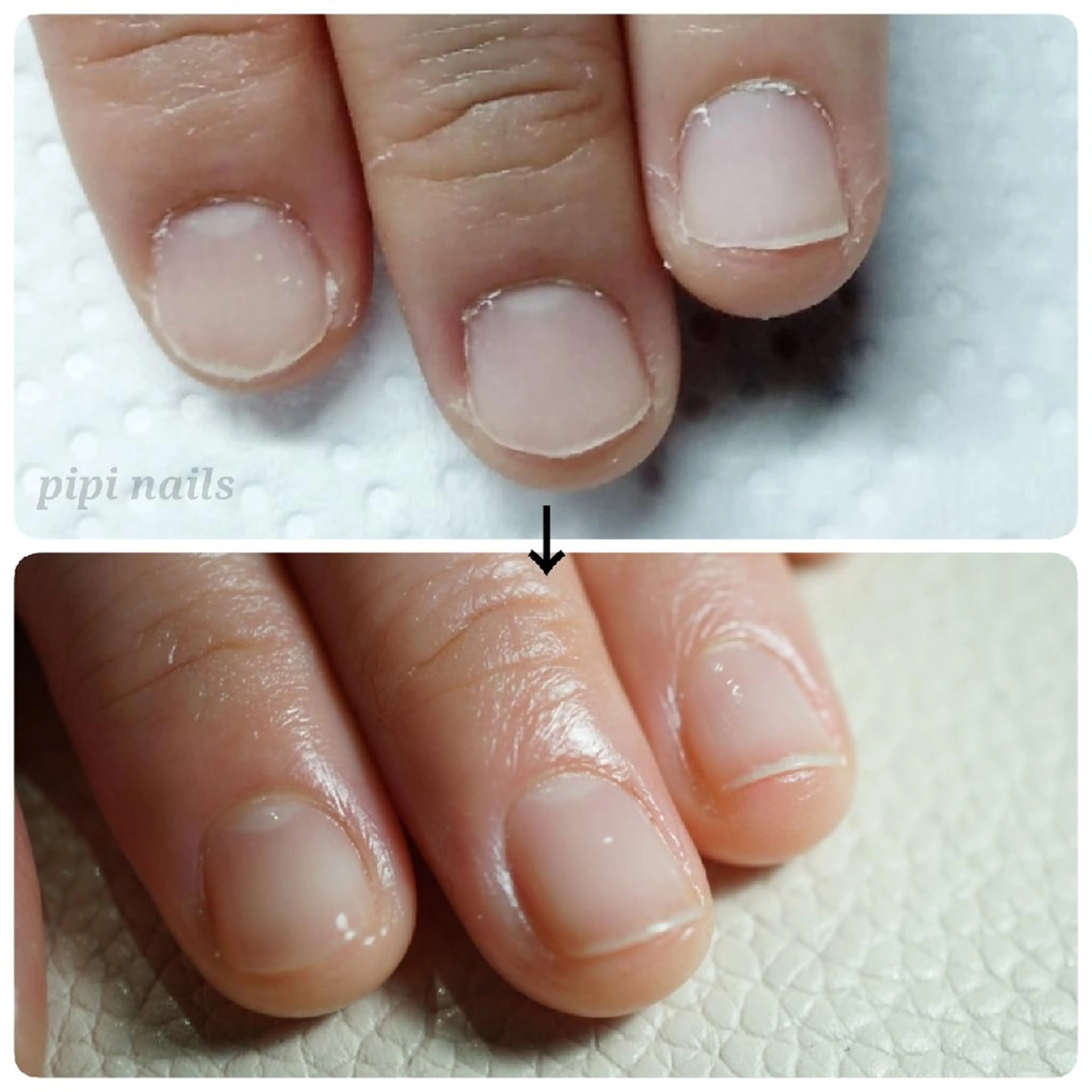 当店深爪ケア2回目の方はこちら【深爪ケアメンテナンス】の写真