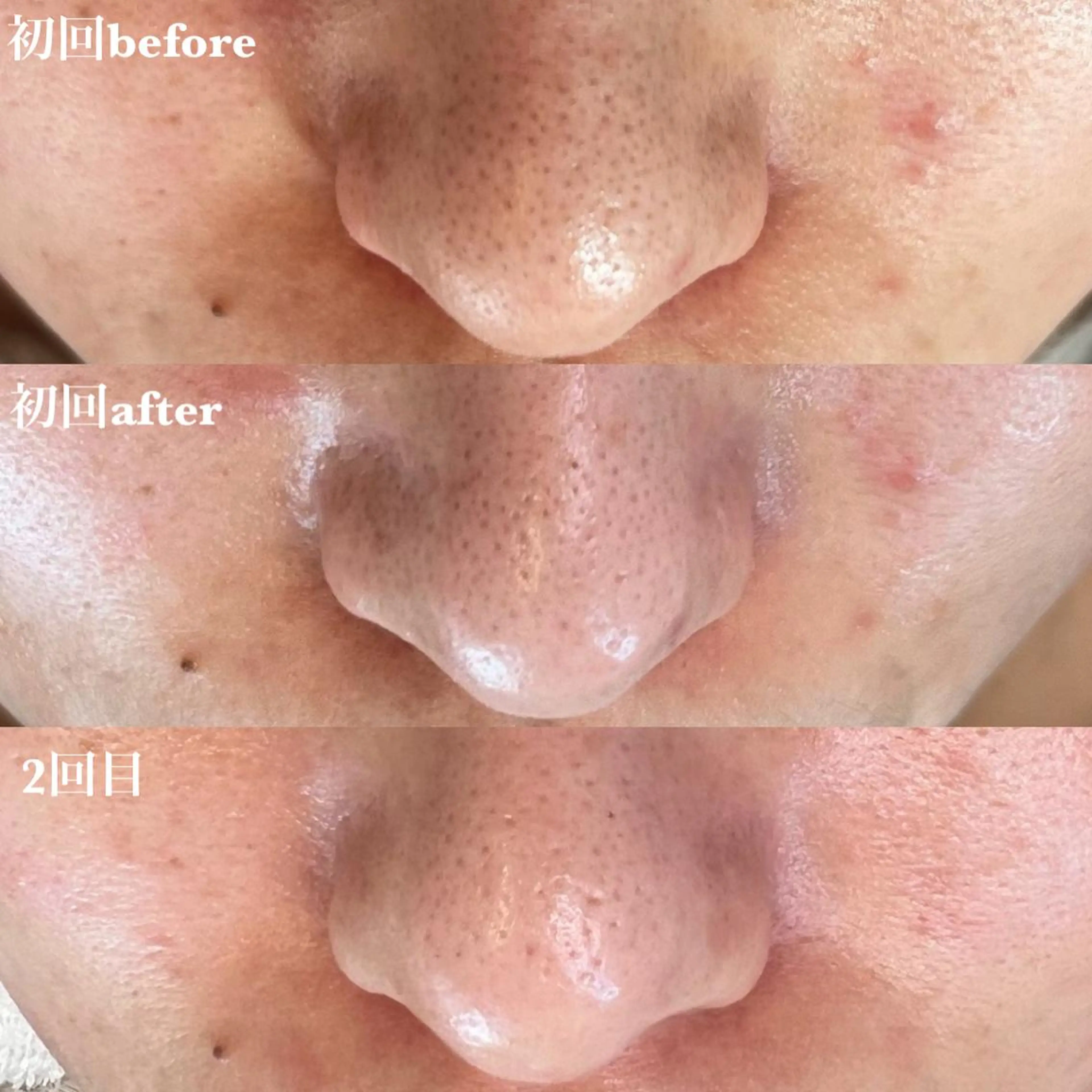 Luana  アイラッシュ& フェイシャル所属・Luana eyelashのマツエク・マツパデザイン