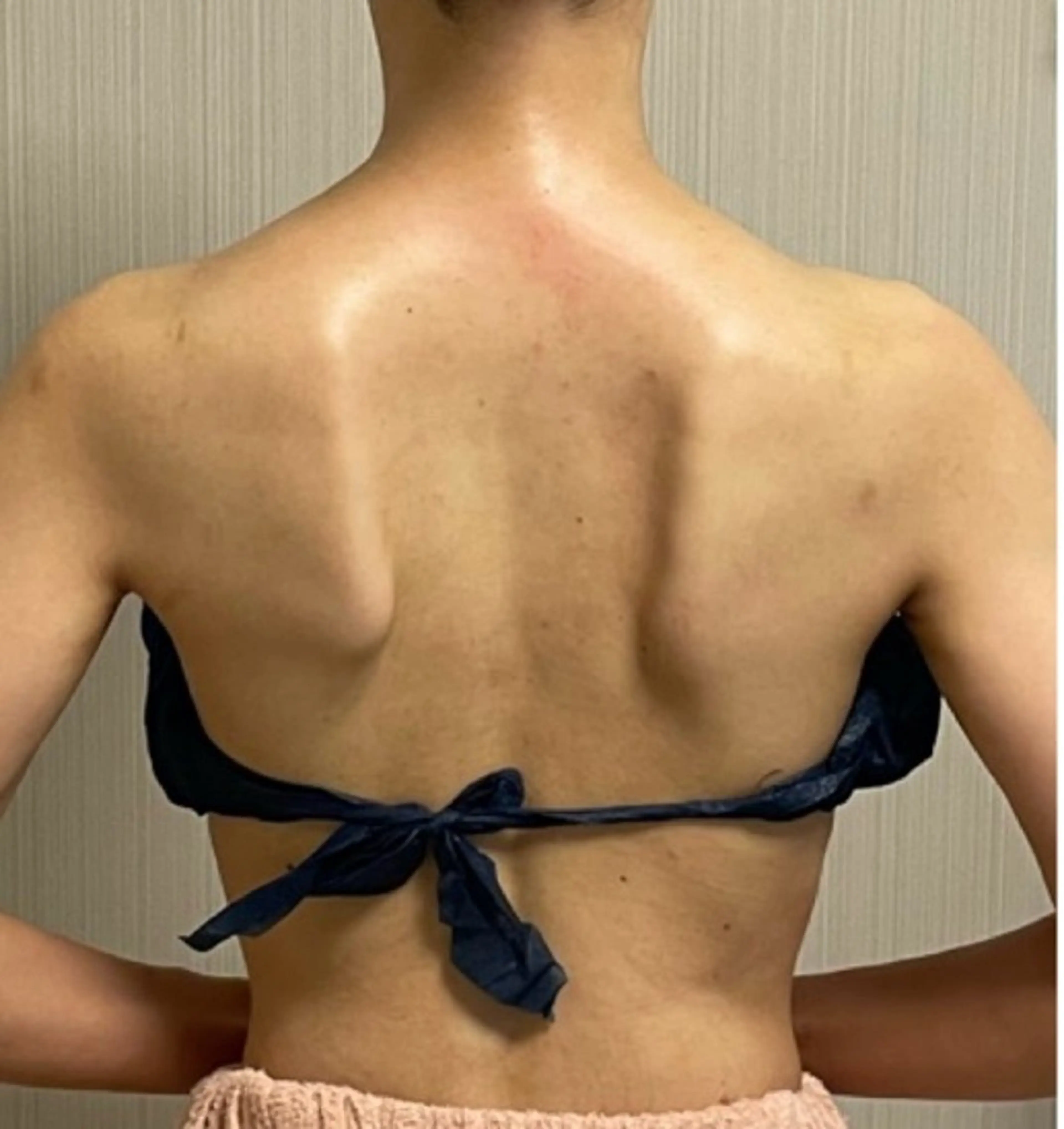 SOLUNA目黒店所属・小顔/毛穴洗浄/痩身 ayako🌿のエステ・リラクイメージ