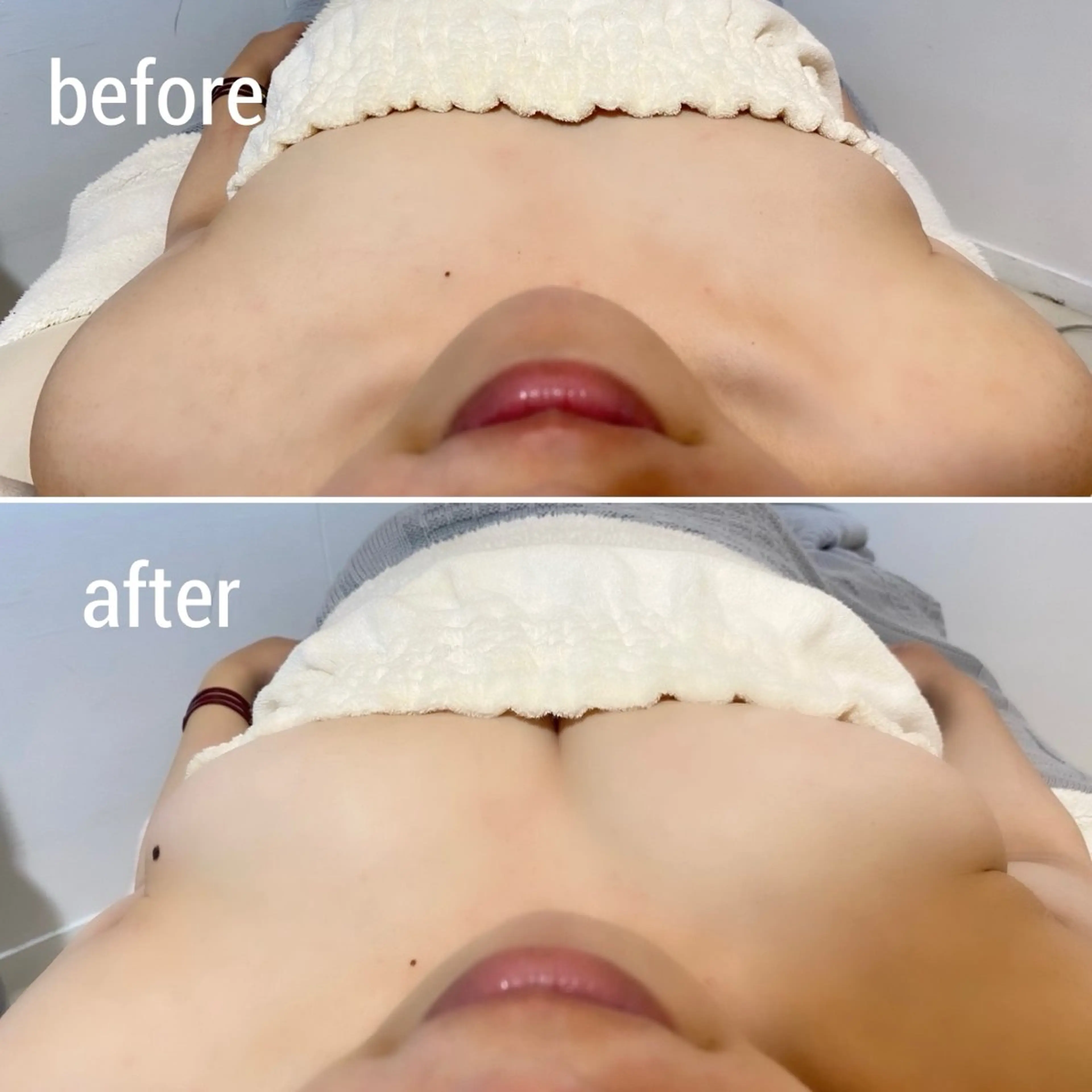 ＊ REIMIのヘアスタイル