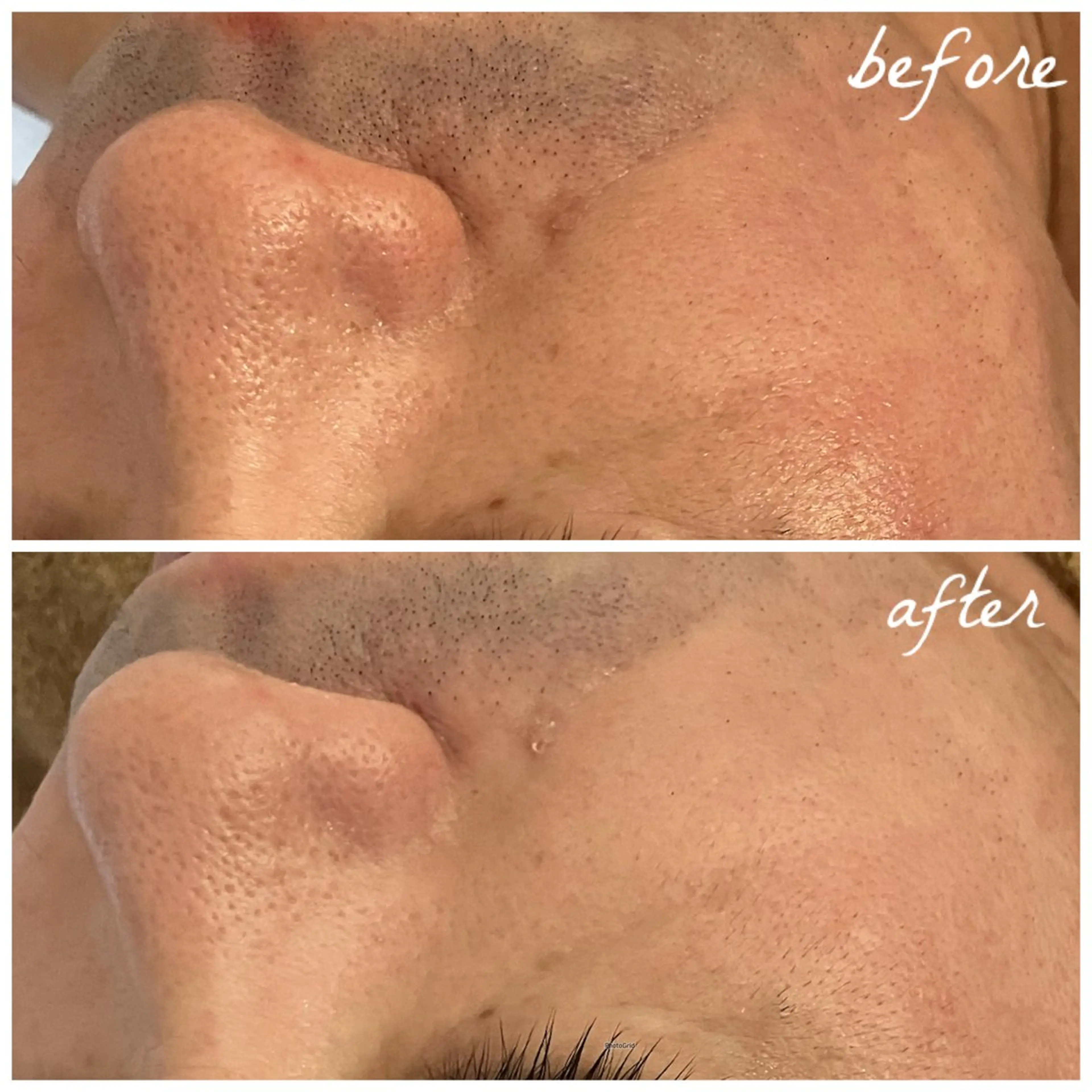 メンズ エステ メナード岐阜茜部 杉浦のエステ・リラクイメージ