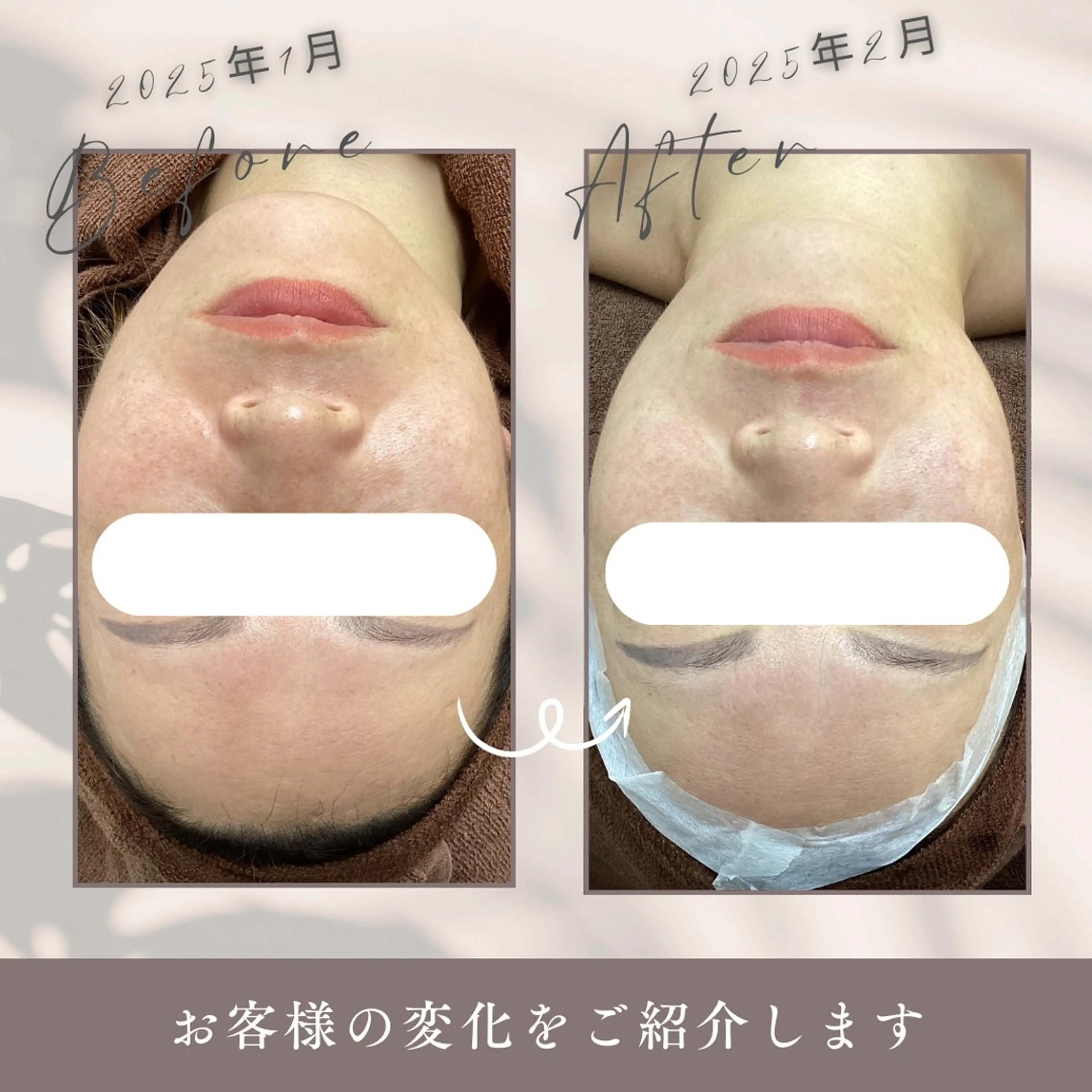 シミケア専科 Babyfaceのエステ・リラクイメージ