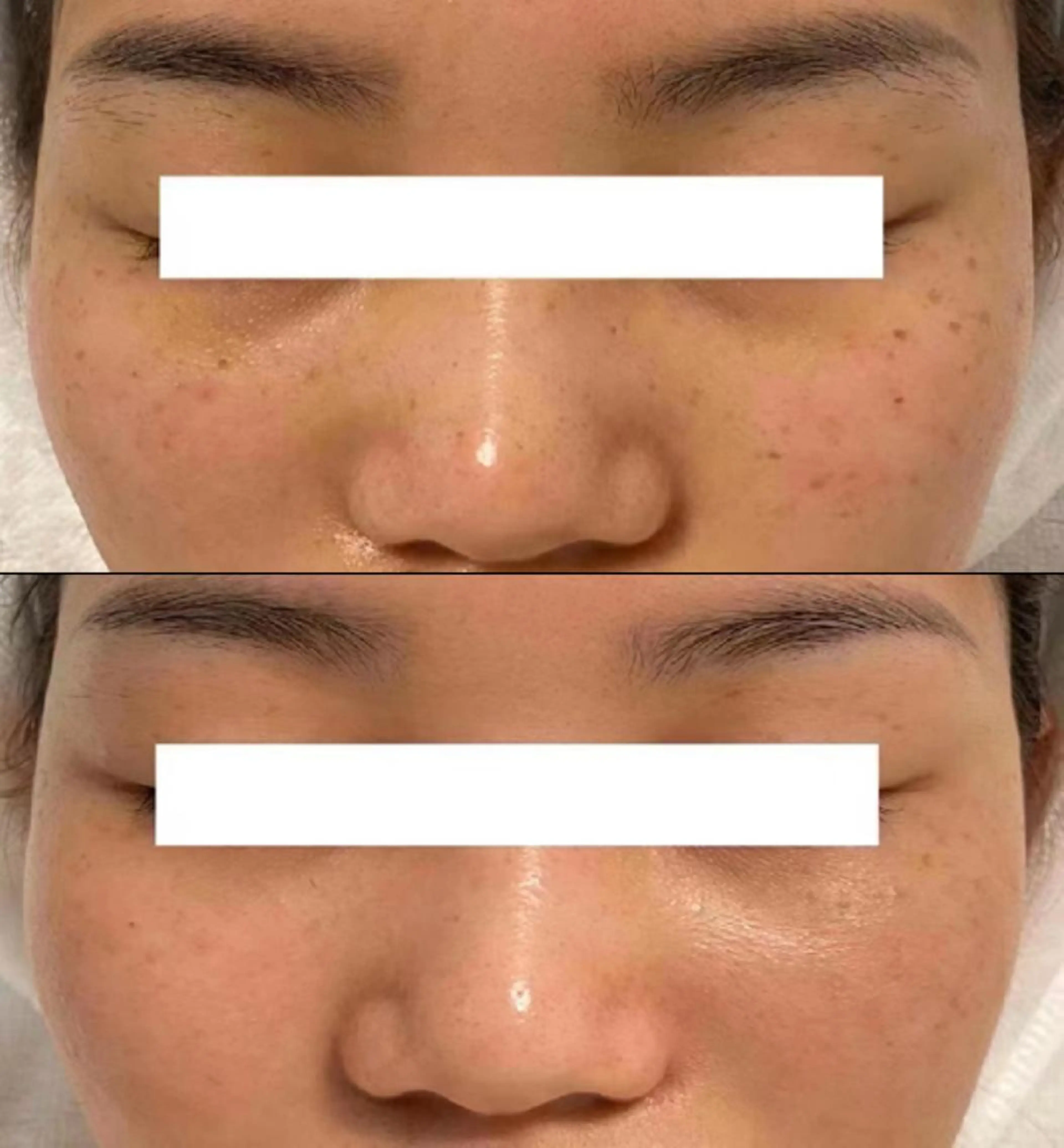 全身脱毛×マッサージ 高岳×新栄×代官町の眉毛・アイブロウイメージ