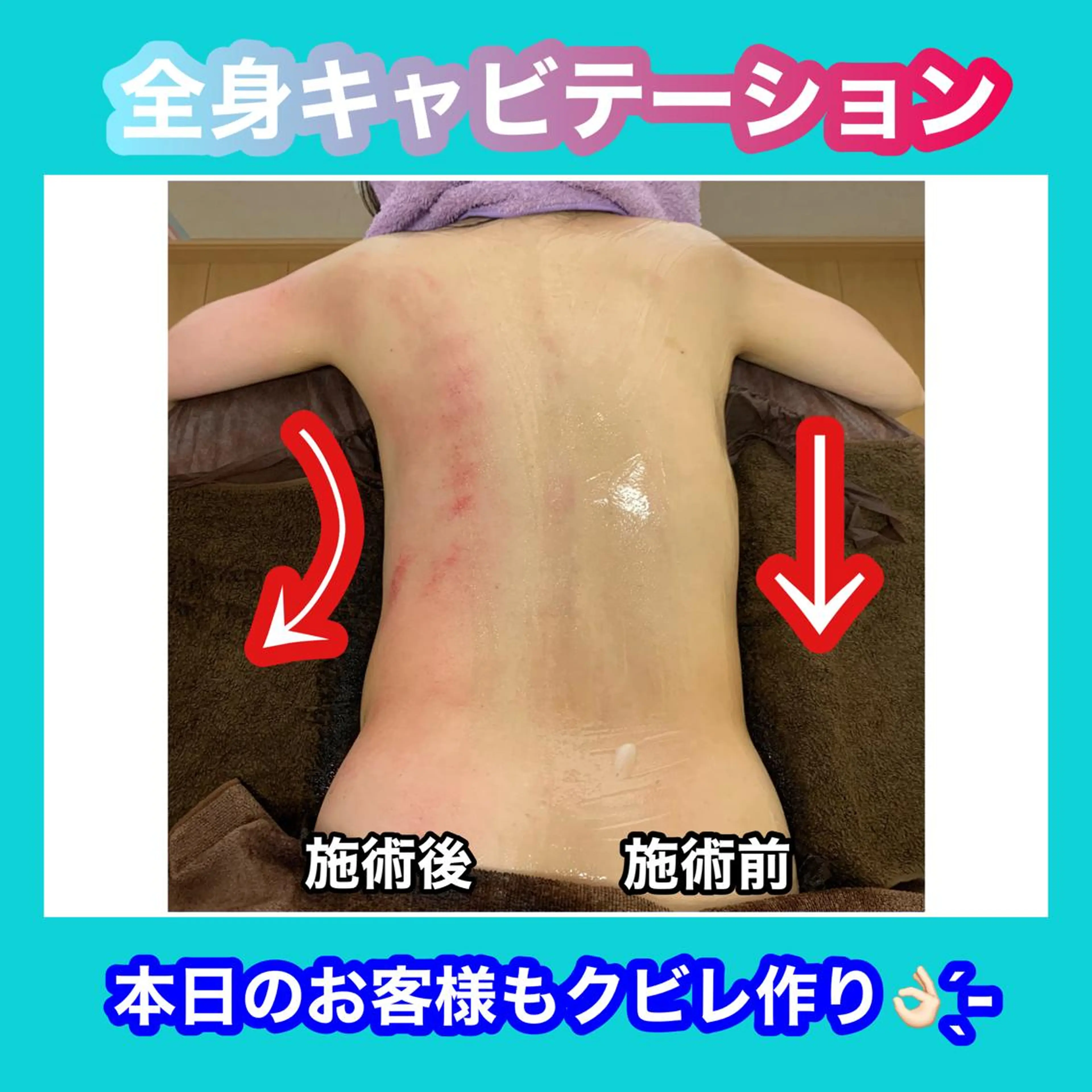 エステ リラク 痩身/脱毛/ネイル HARUKAのエステ・リラクイメージ