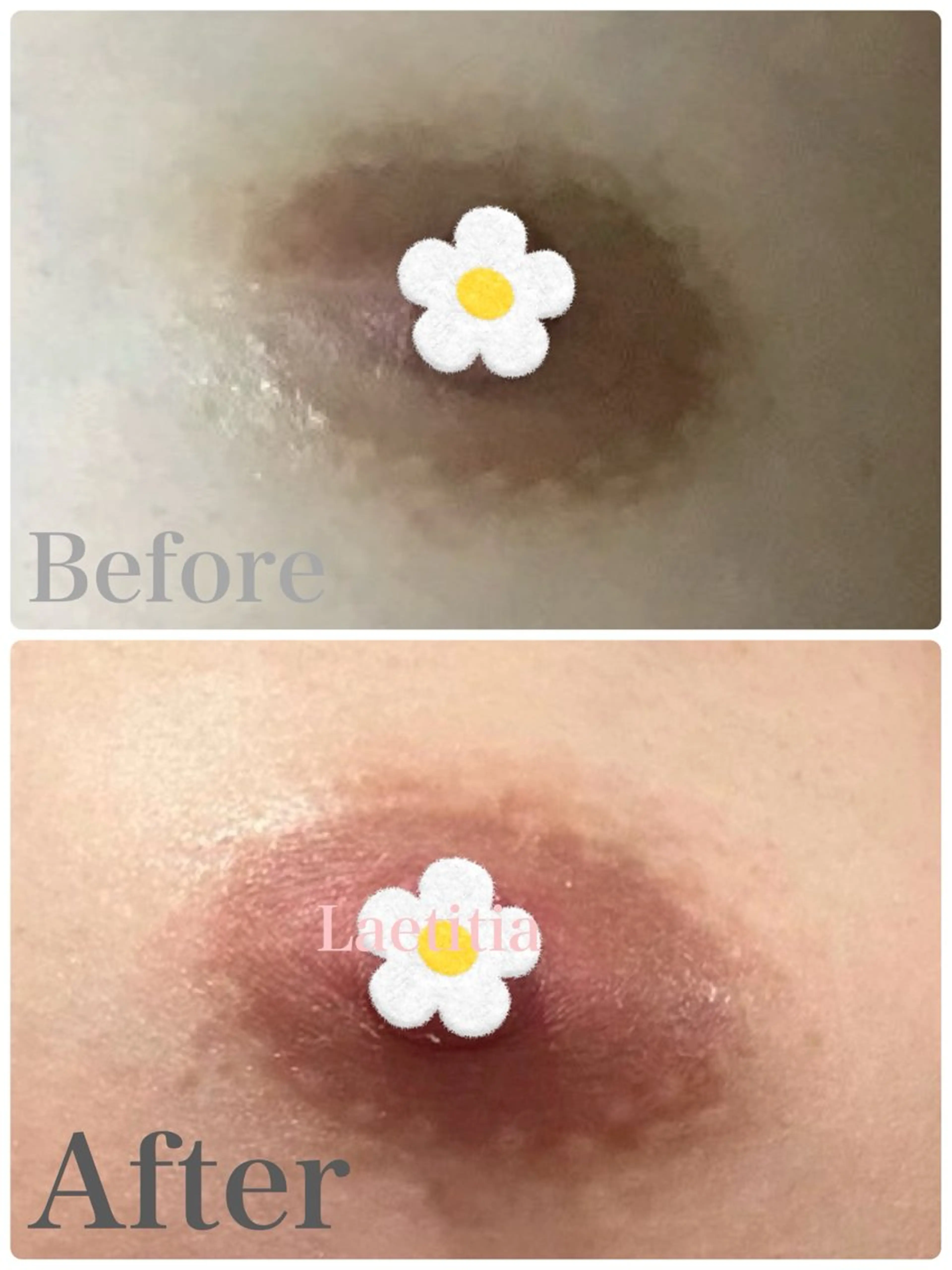 【1/31まで】ローマピンク🌸ニップル&Iラインの写真