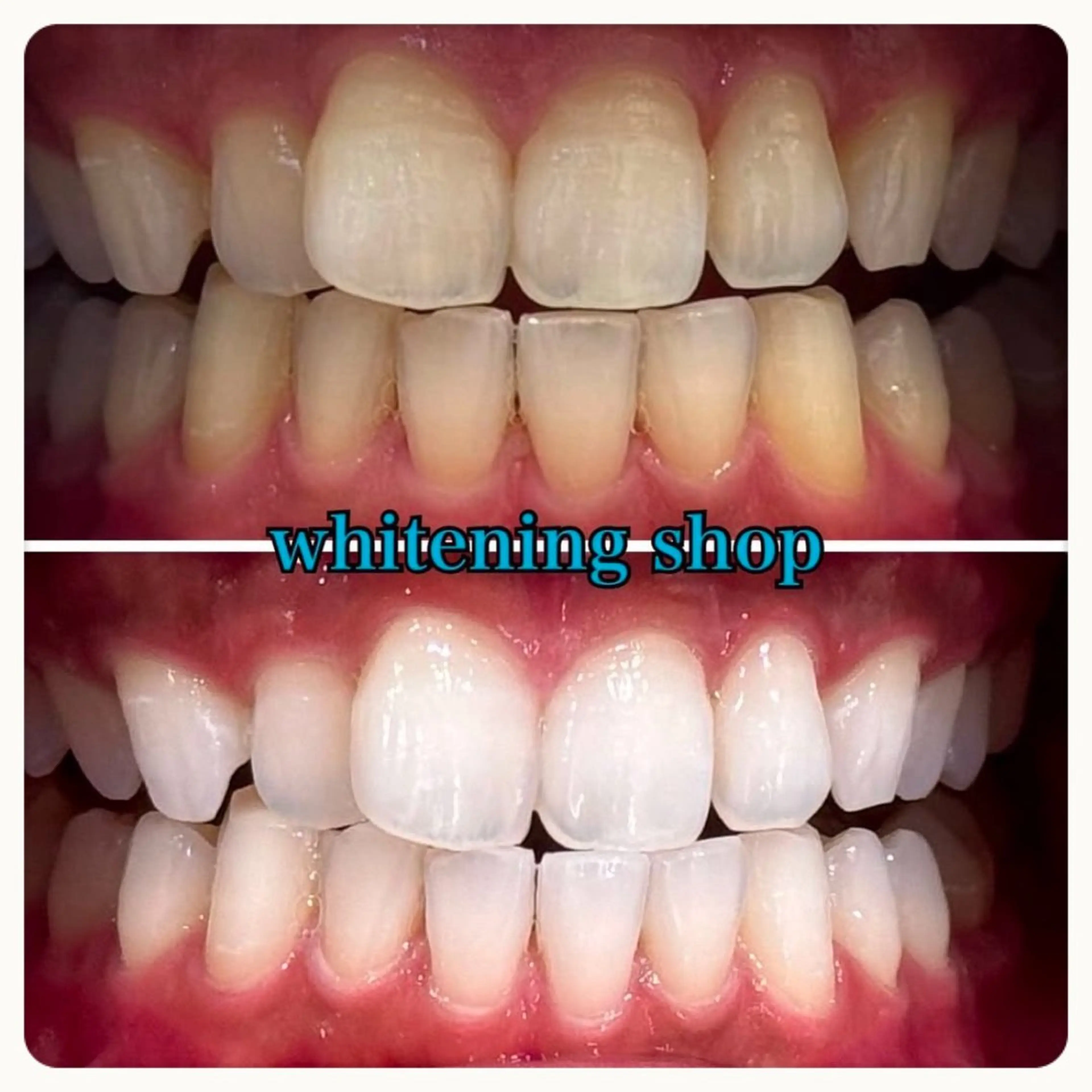 その他 ホワイトニング ショップ吉祥寺2号店のその他イメージ