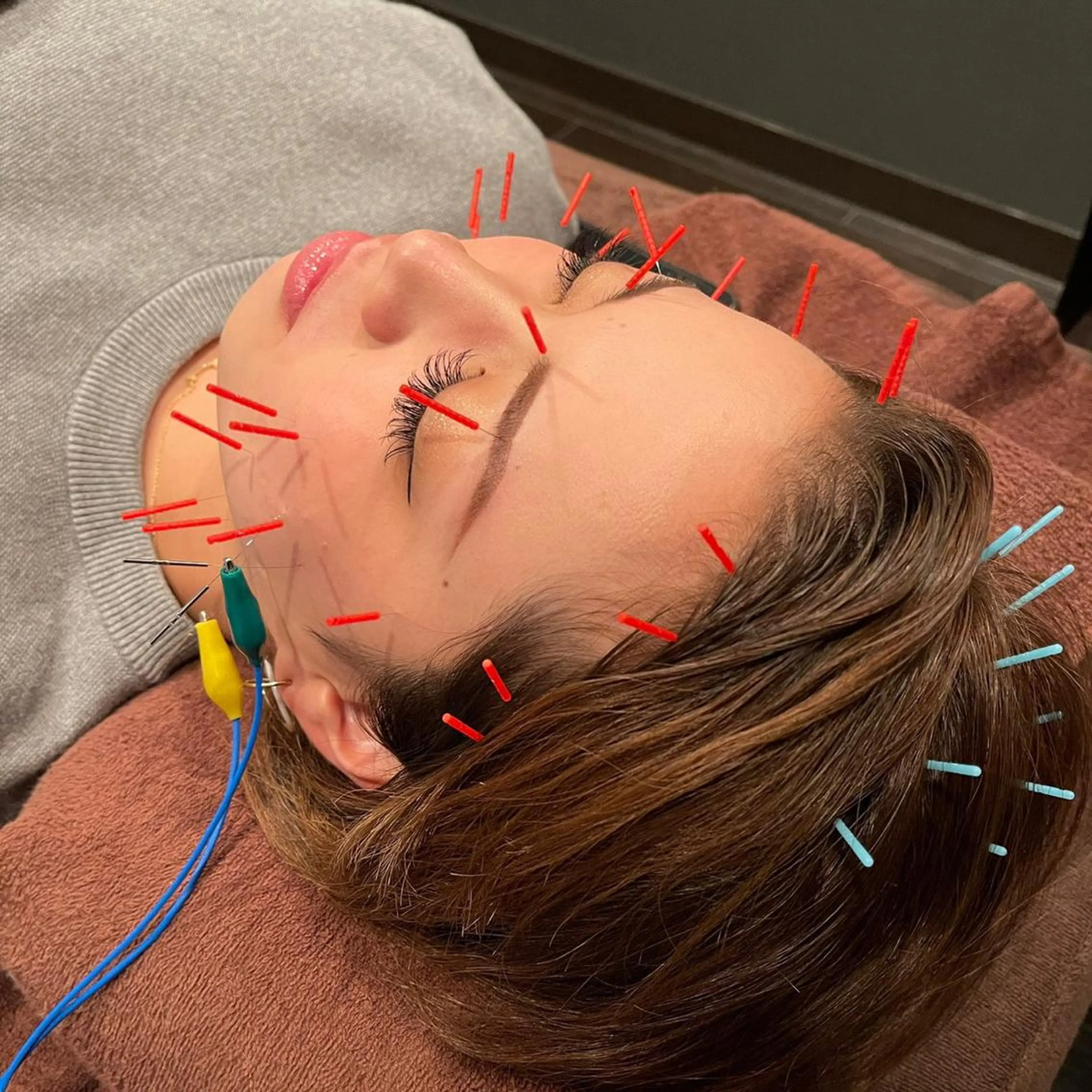 小林整骨院玉川 キジマのエステ・リラクイメージ