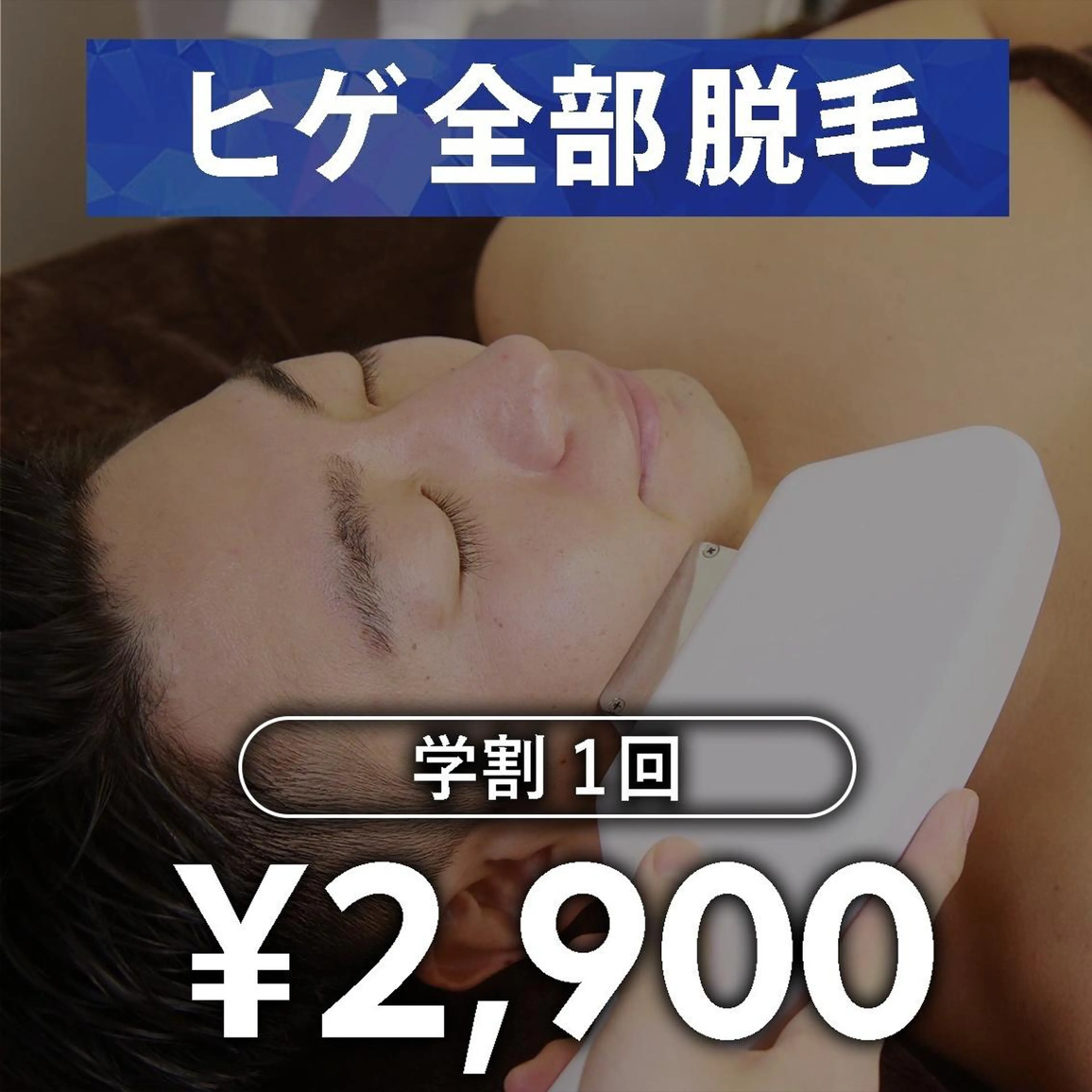 【メンズ脱毛】ヒゲ脱毛　学割U24　1回の写真