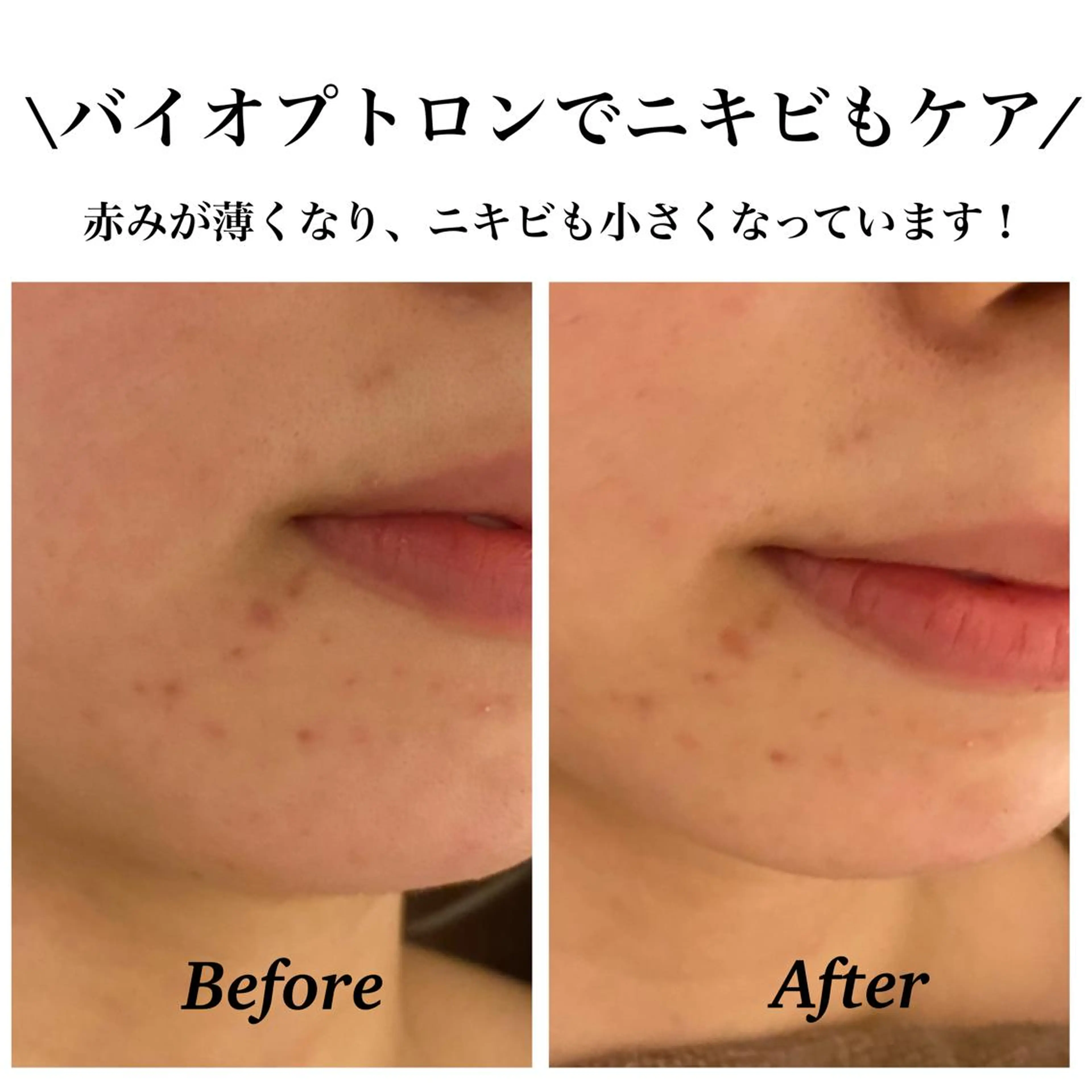 Bellesthe (ベルエステ)のエステ・リラクイメージ