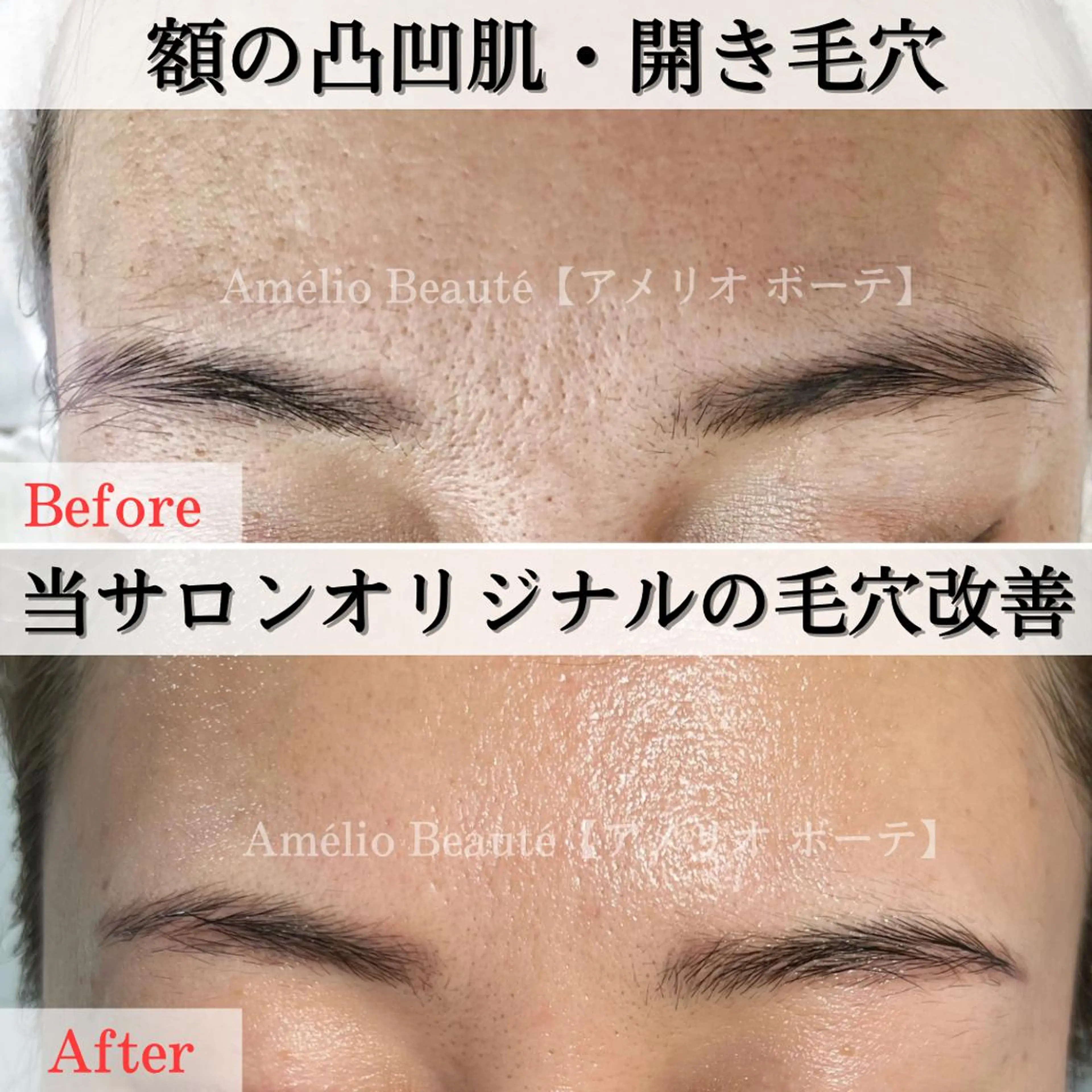 毛穴ケア専門サロン Amélio Beauté所属・毛穴ケア専門サロン アメリオボーテのその他イメージ