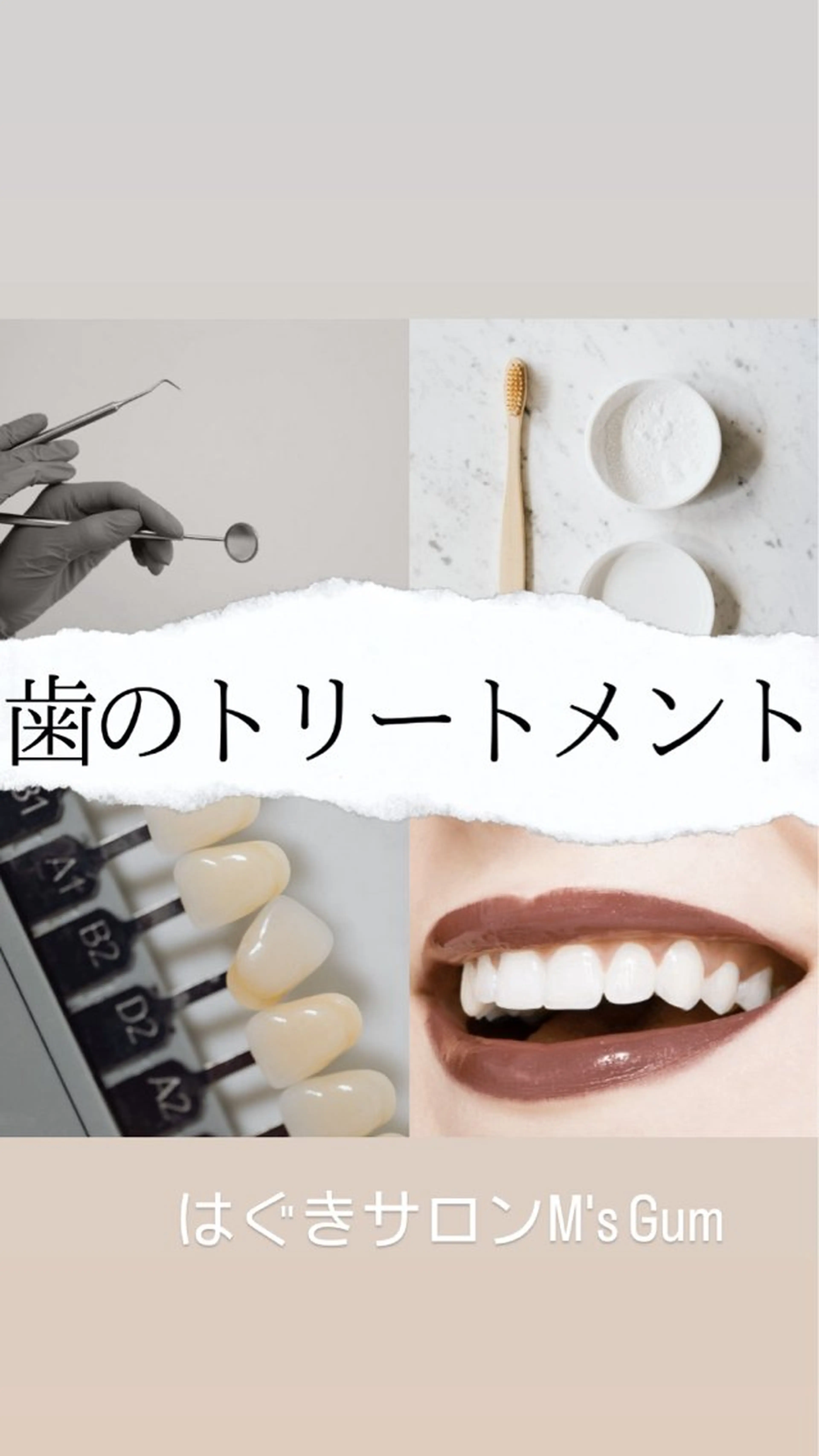 オプションメニュー　歯のトリートメントの写真