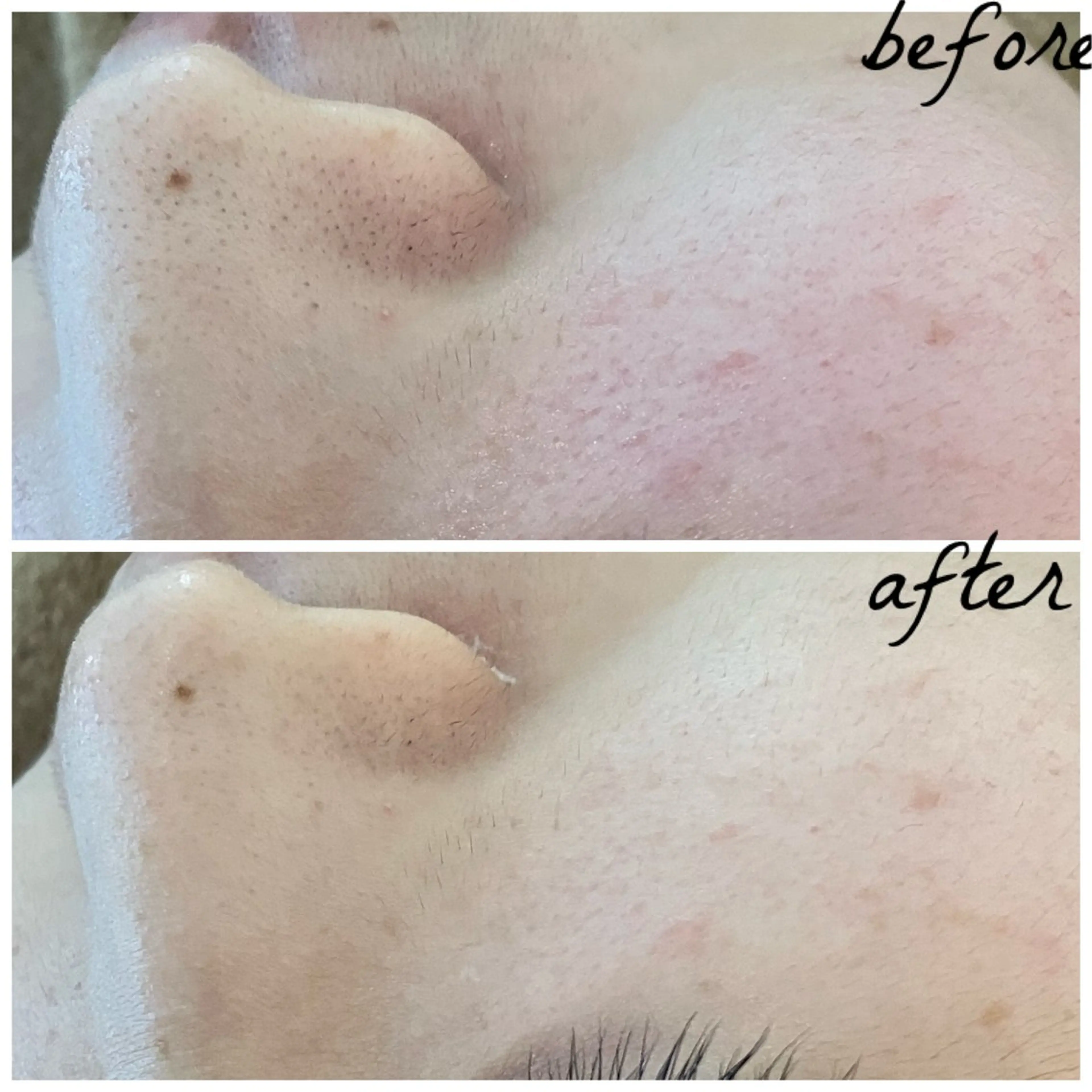 メンズ メナード岐阜茜部 杉浦のエステ・リラクイメージ