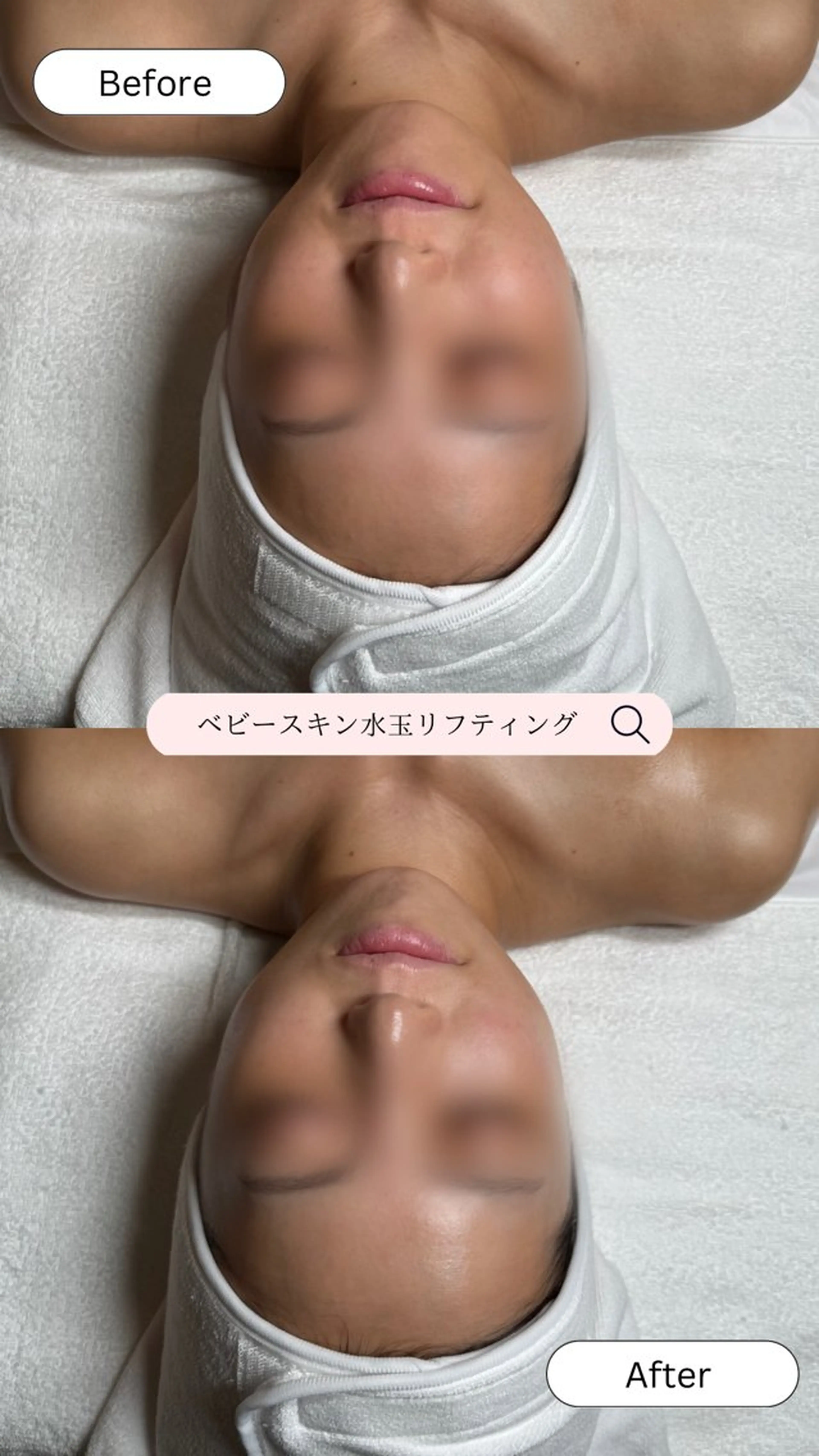 韓国肌管理🫧LDM 🫧Junnaのエステ・リラクイメージ