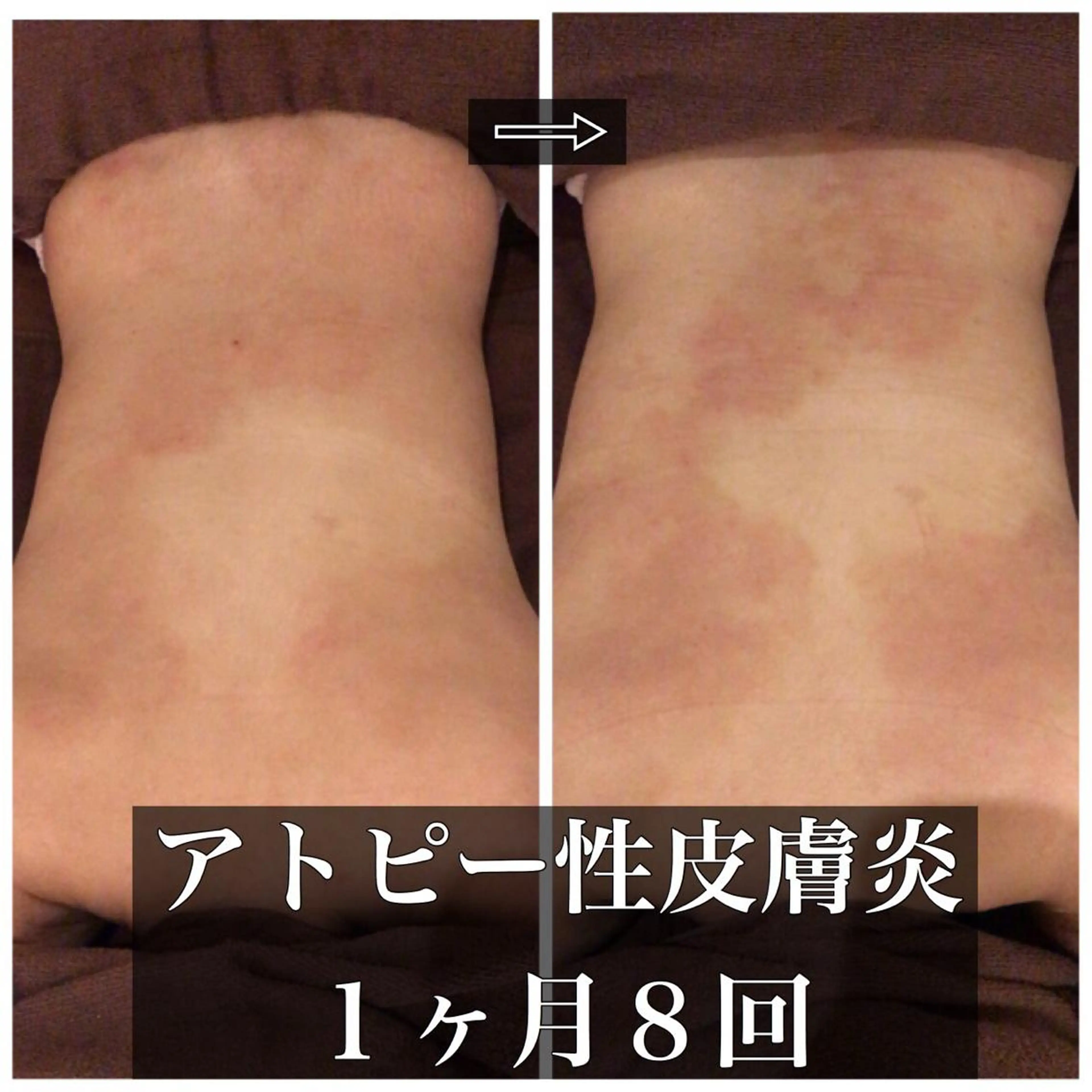 ミディアム カラー パーマ ヘアアレンジ メンズ キッズ ネイル マツエク・マツパ エステ リラク ニキビ・肌質改善専門 ♡人生が変わるサロンのエステ・リラクイメージ