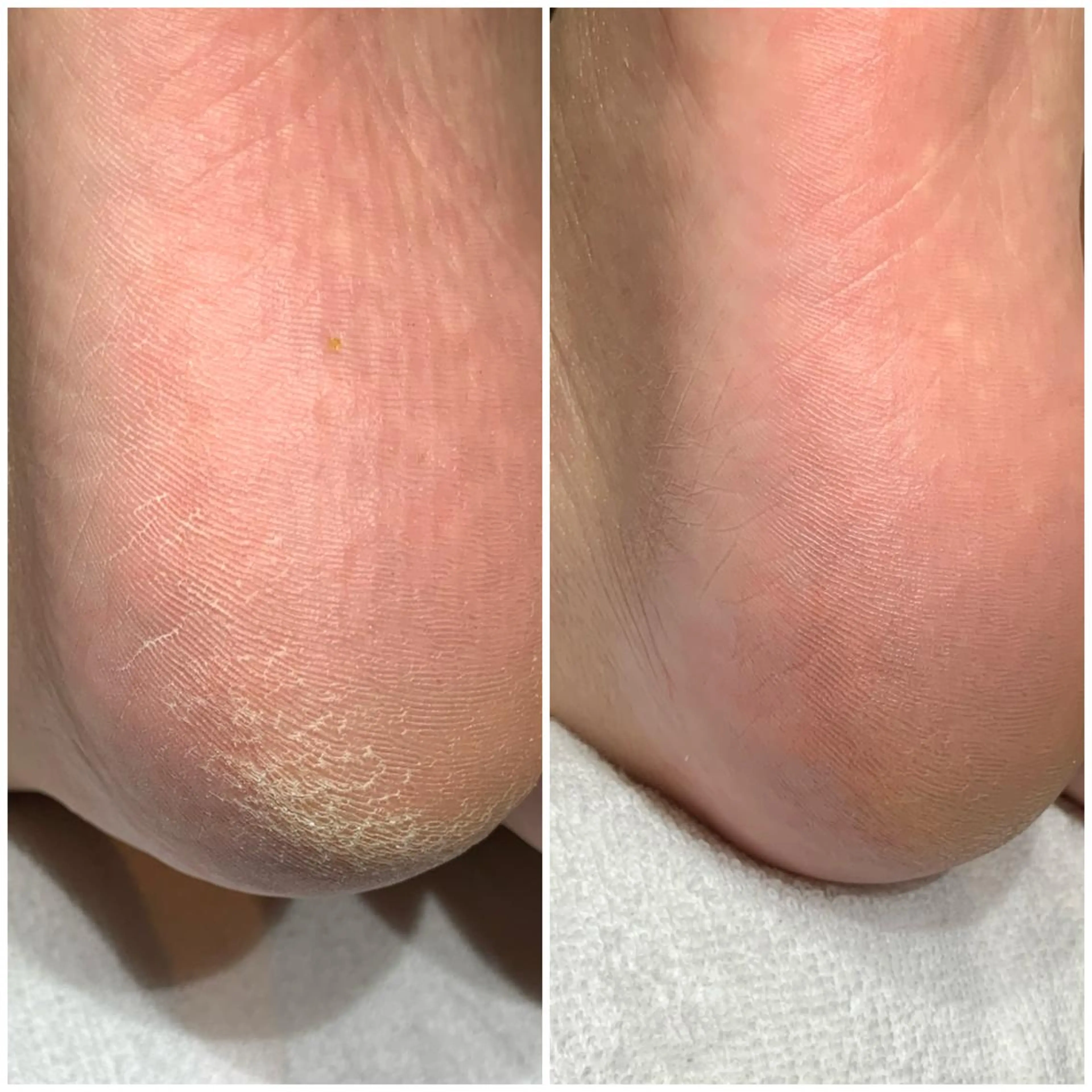 ネイル ROUN'　南 鈴沙のネイルデザイン