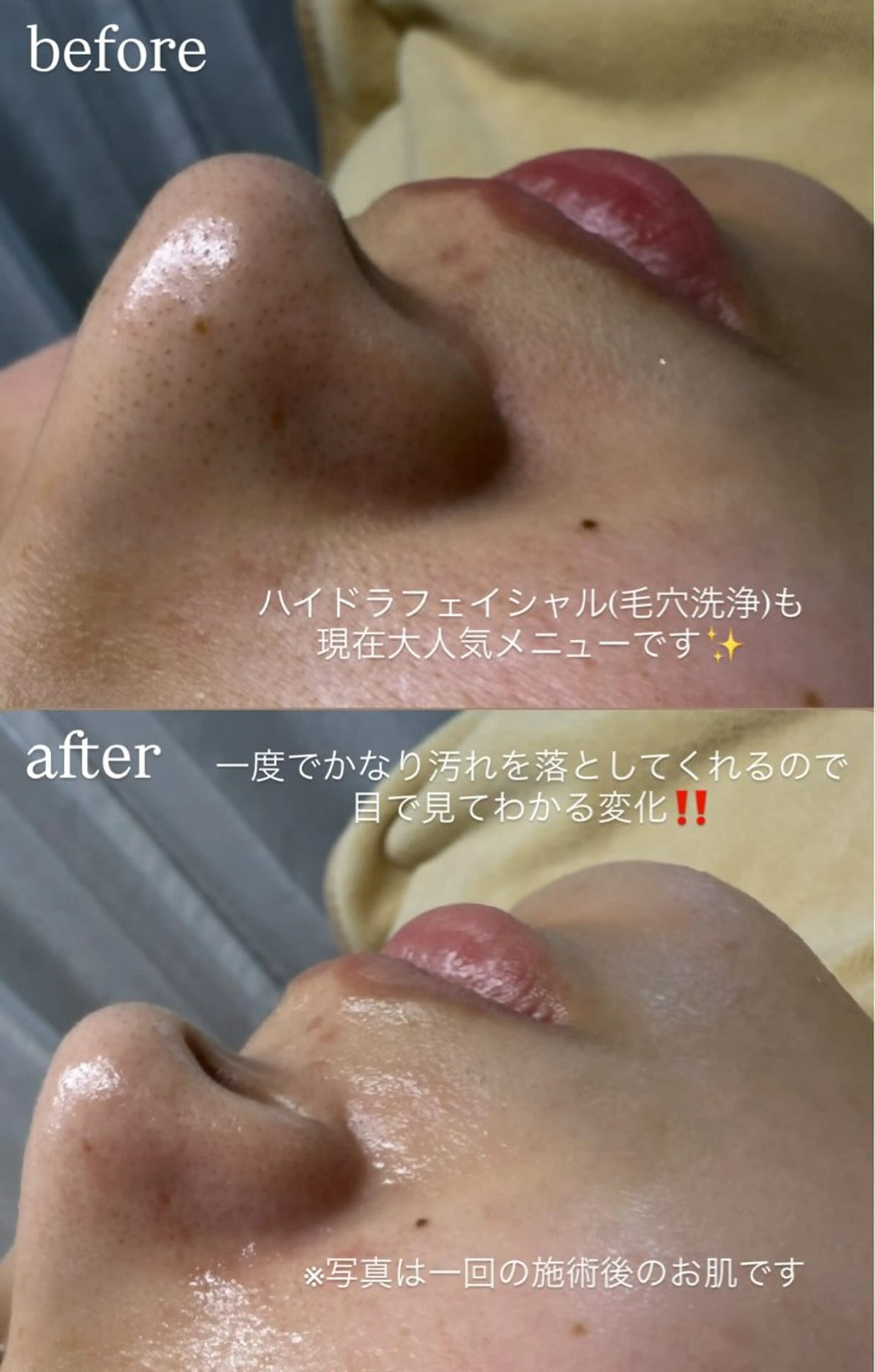 その他 répos所属・美容サロン réposのその他イメージ