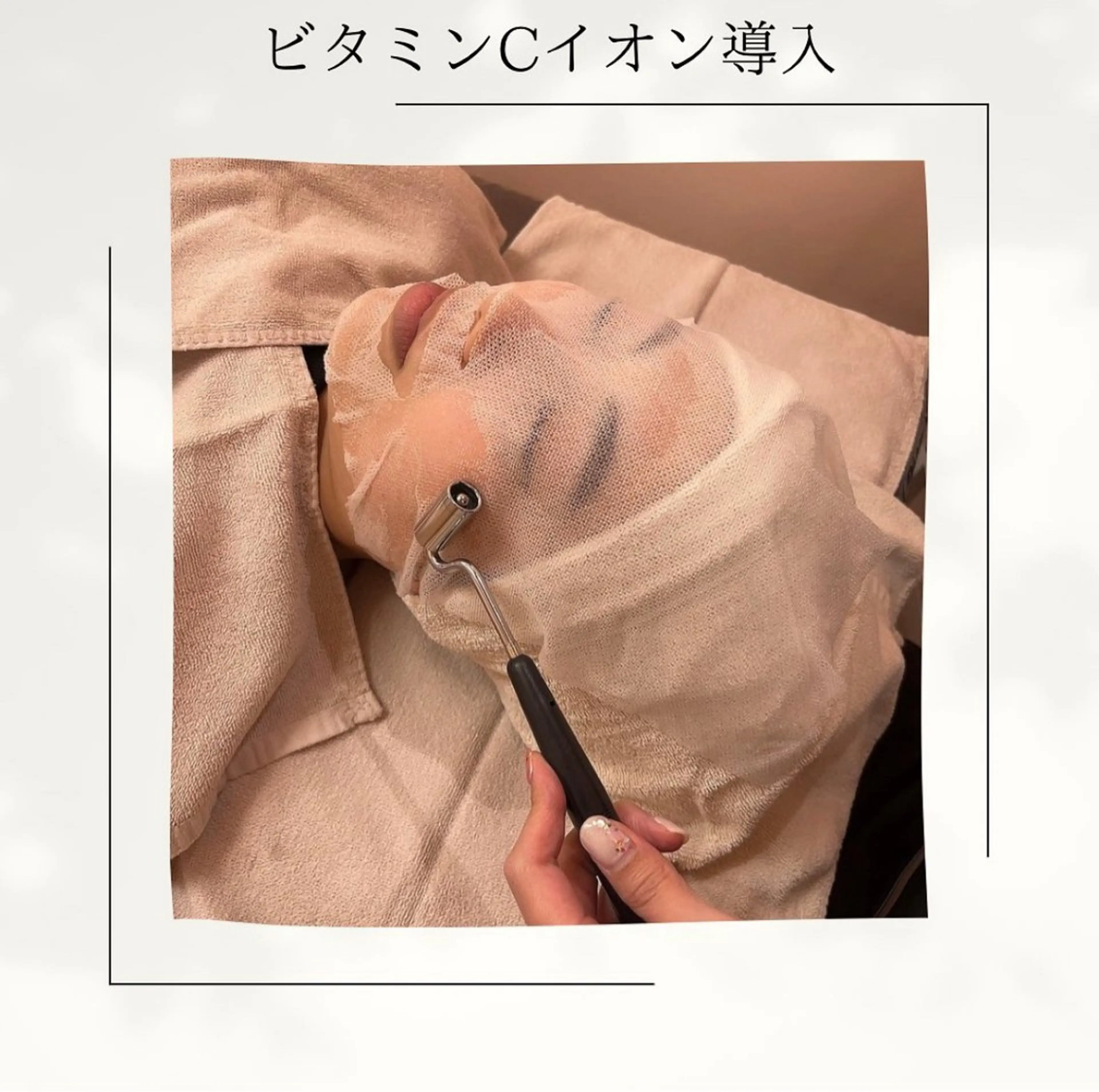 トーンアップ、美白、ニキビ跡に！ビタミンCイオン導入（脱毛施術無料チケット付き）の写真