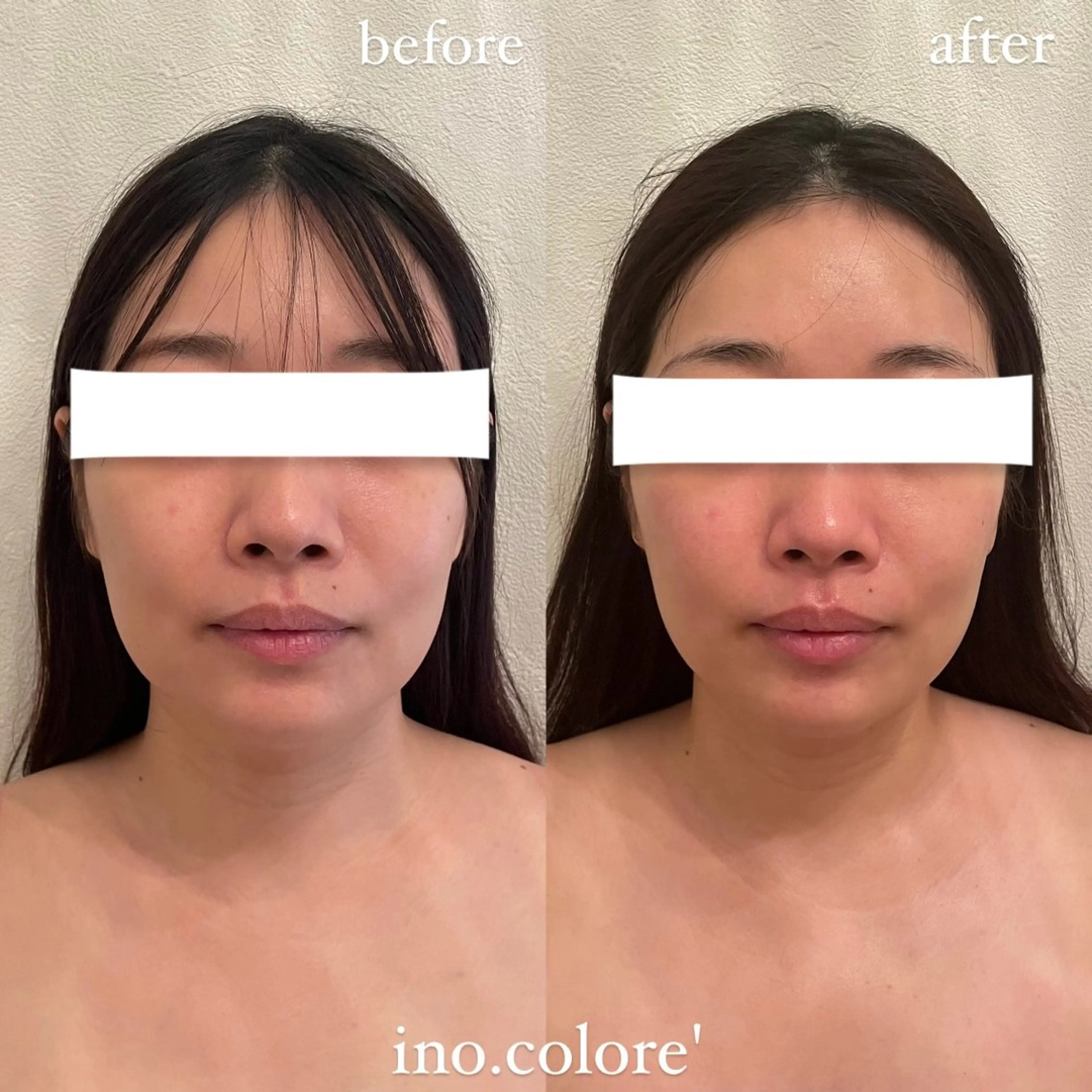 エステ リラク エステサロンino.colore'所属・小顔サロン ino.coloreのエステ・リラクイメージ