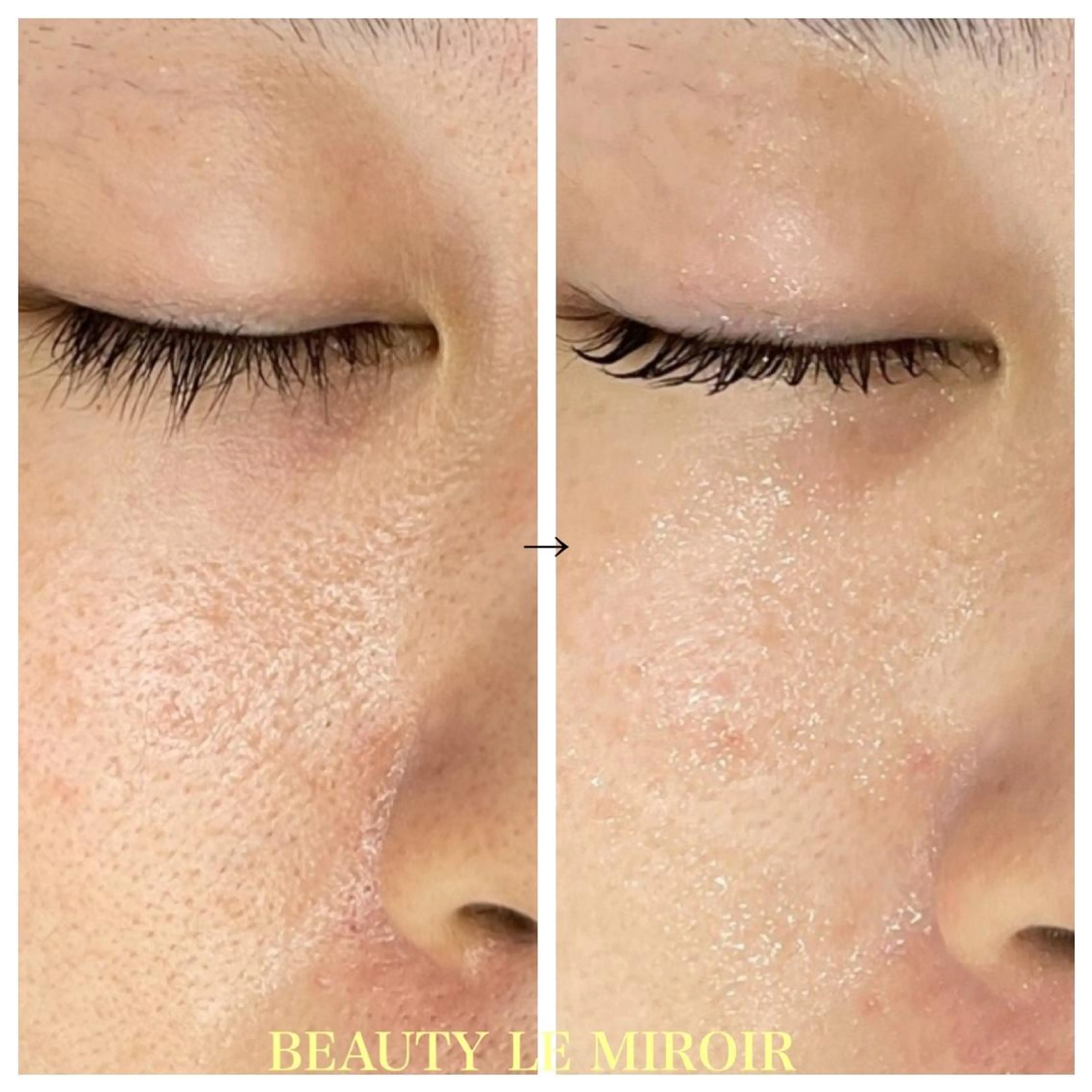 ビューティー ミロワールのエステ・リラクイメージ