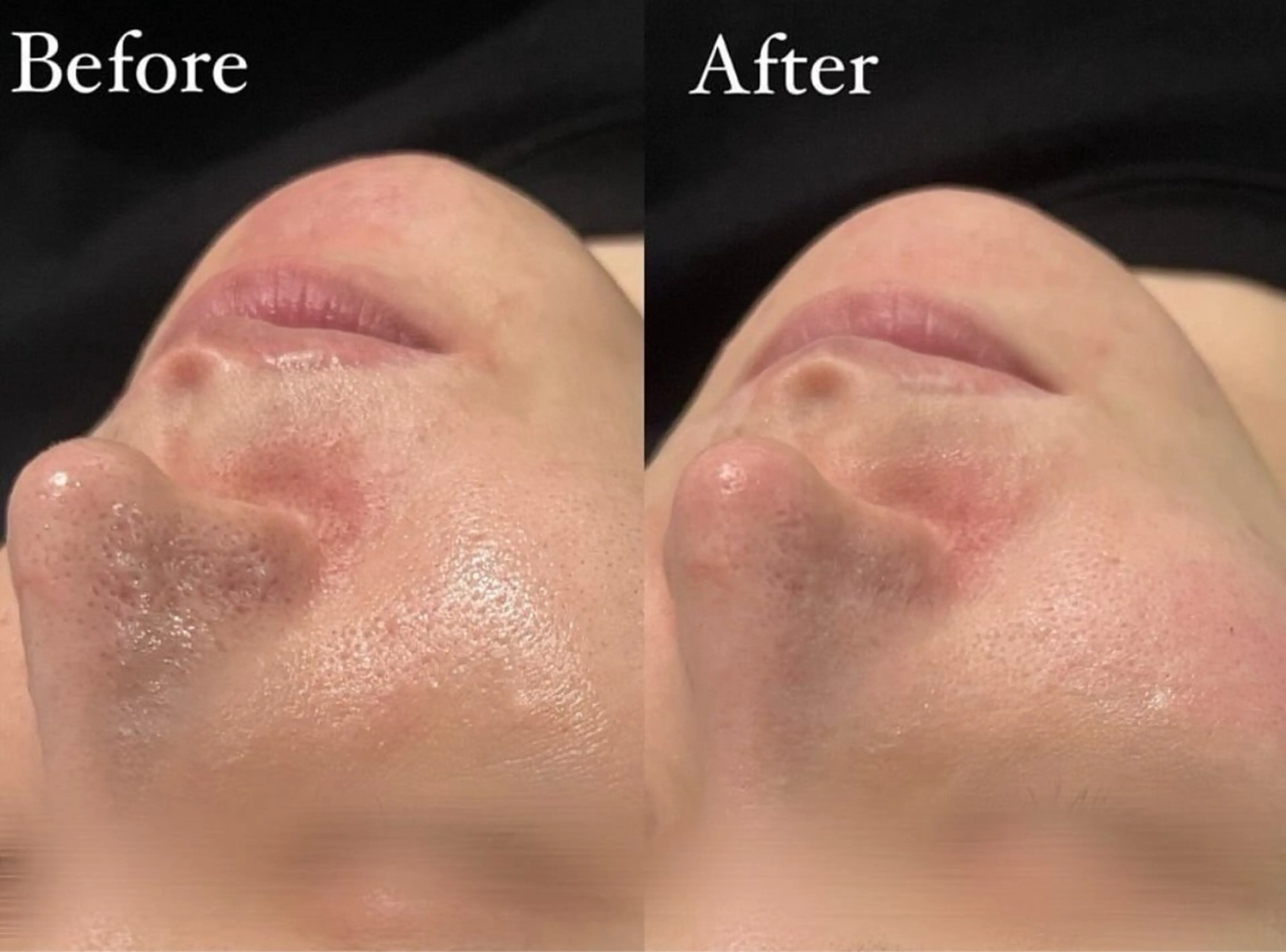 Belle原宿所属・佐藤 加奈のエステ・リラクイメージ