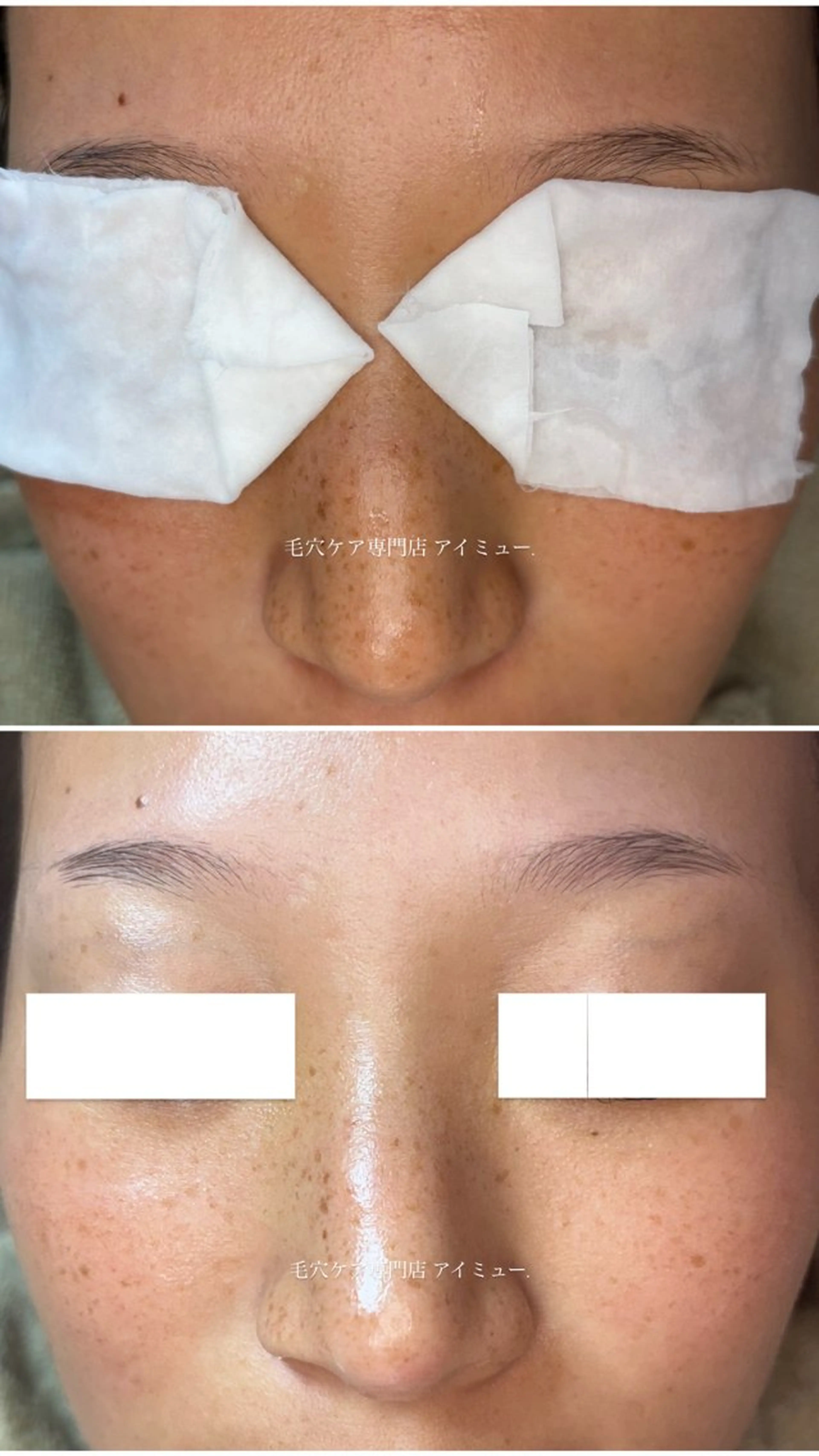 毛穴専門店アイミュー mamiのエステ・リラクイメージ