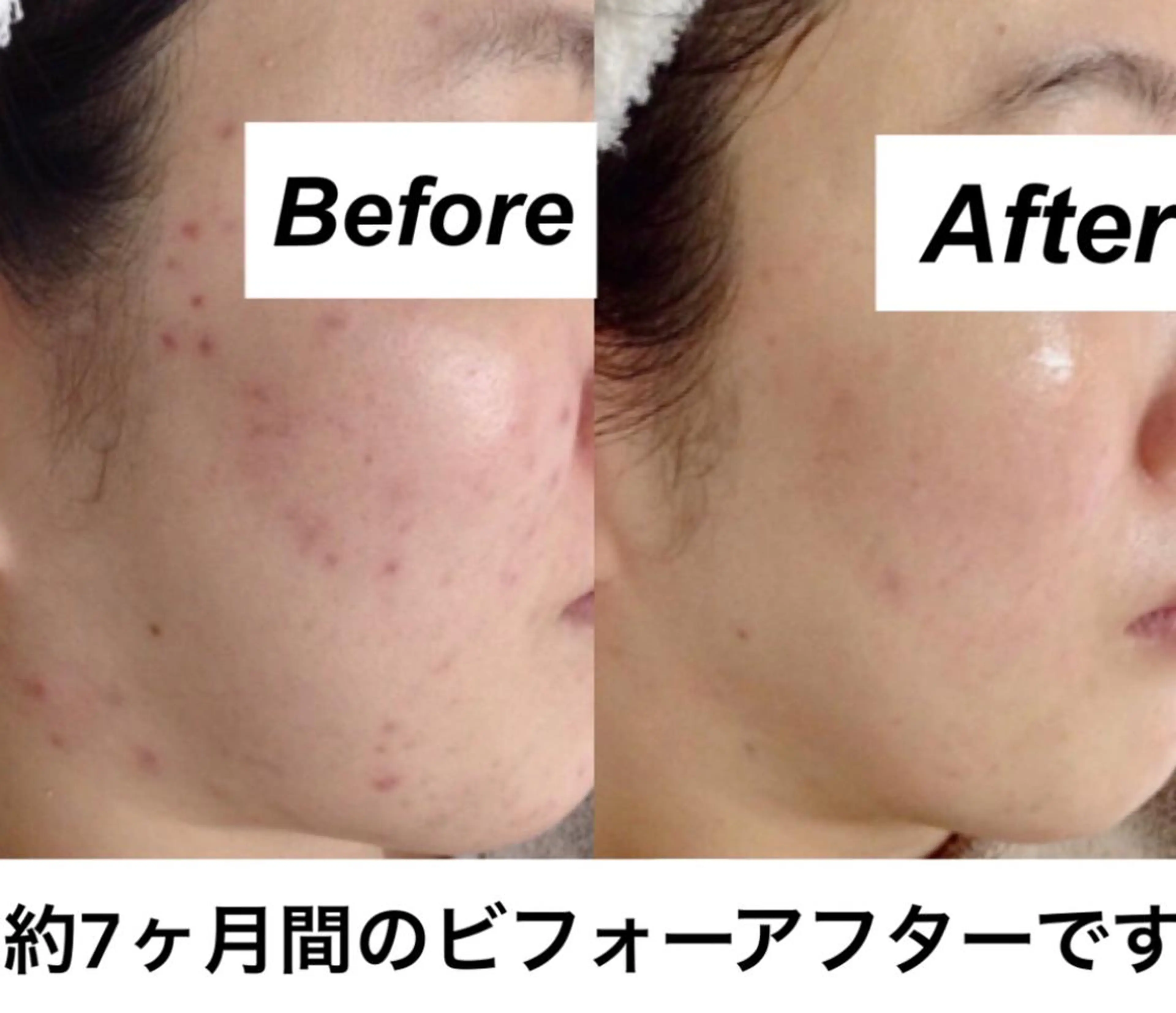 エステ リラク 都度払い肌質改善 &脱毛Blancheのエステ・リラクイメージ