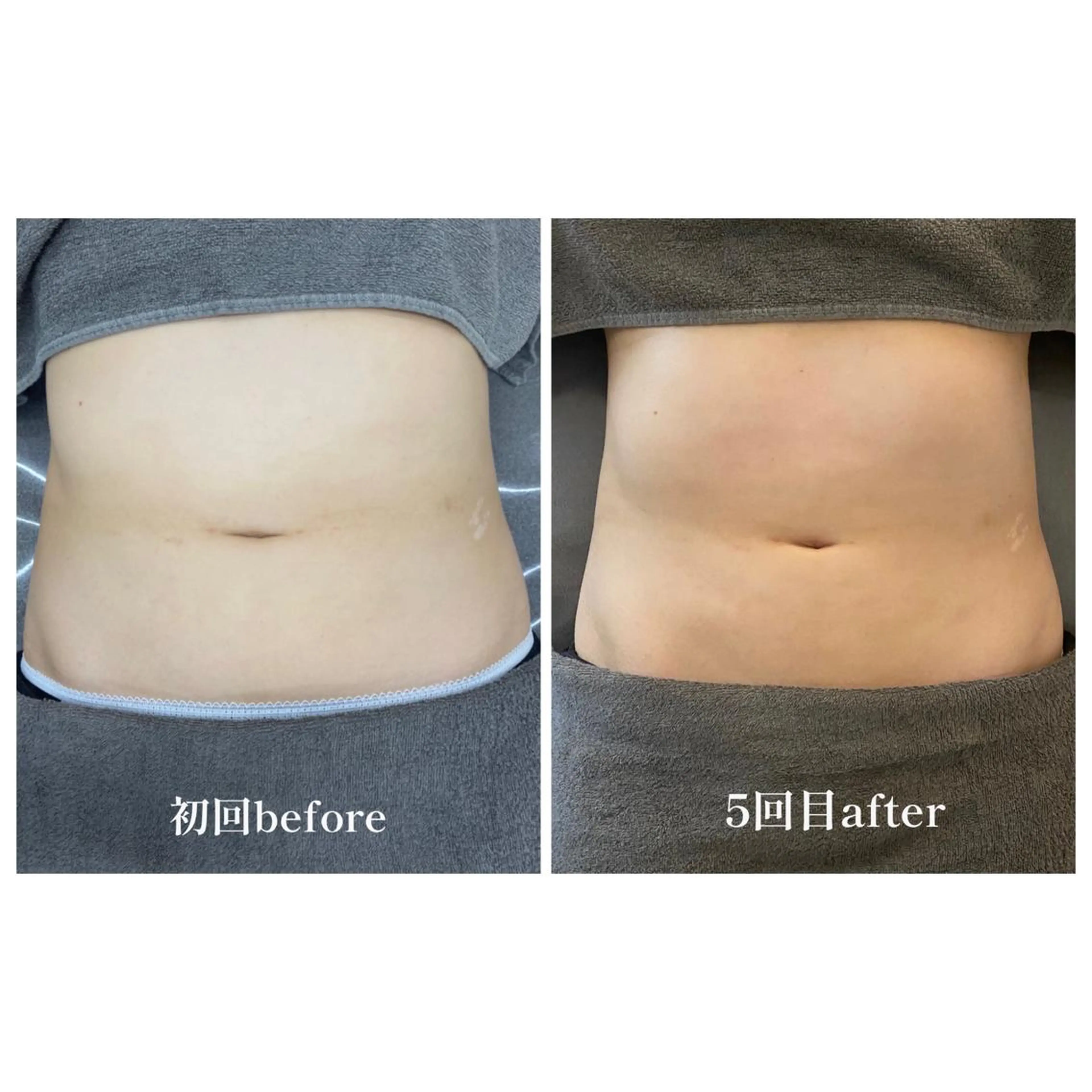 温活未病ケアサロン CoQのエステ・リラクイメージ