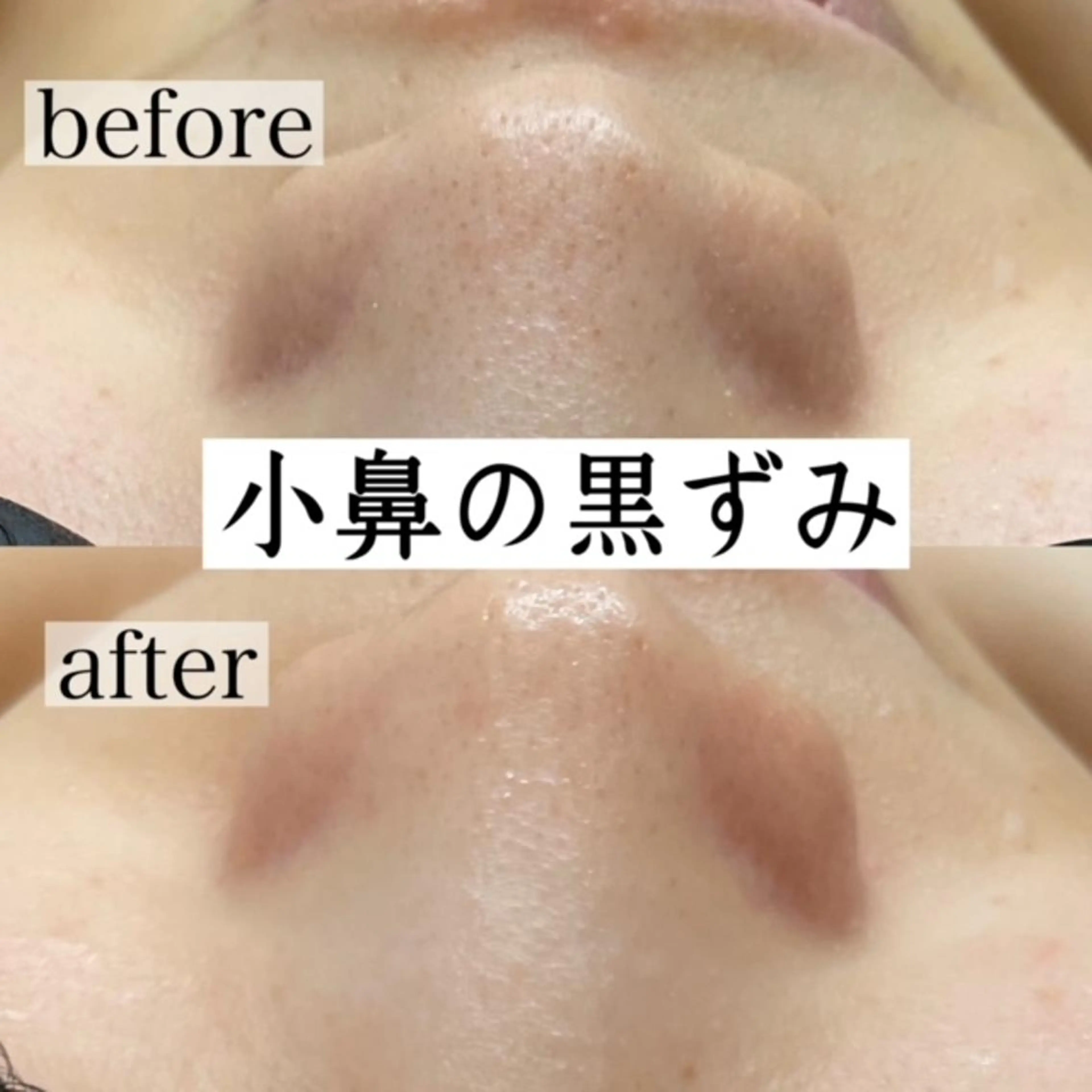 エステ RinRin 甲府店のエステ・リラクイメージ