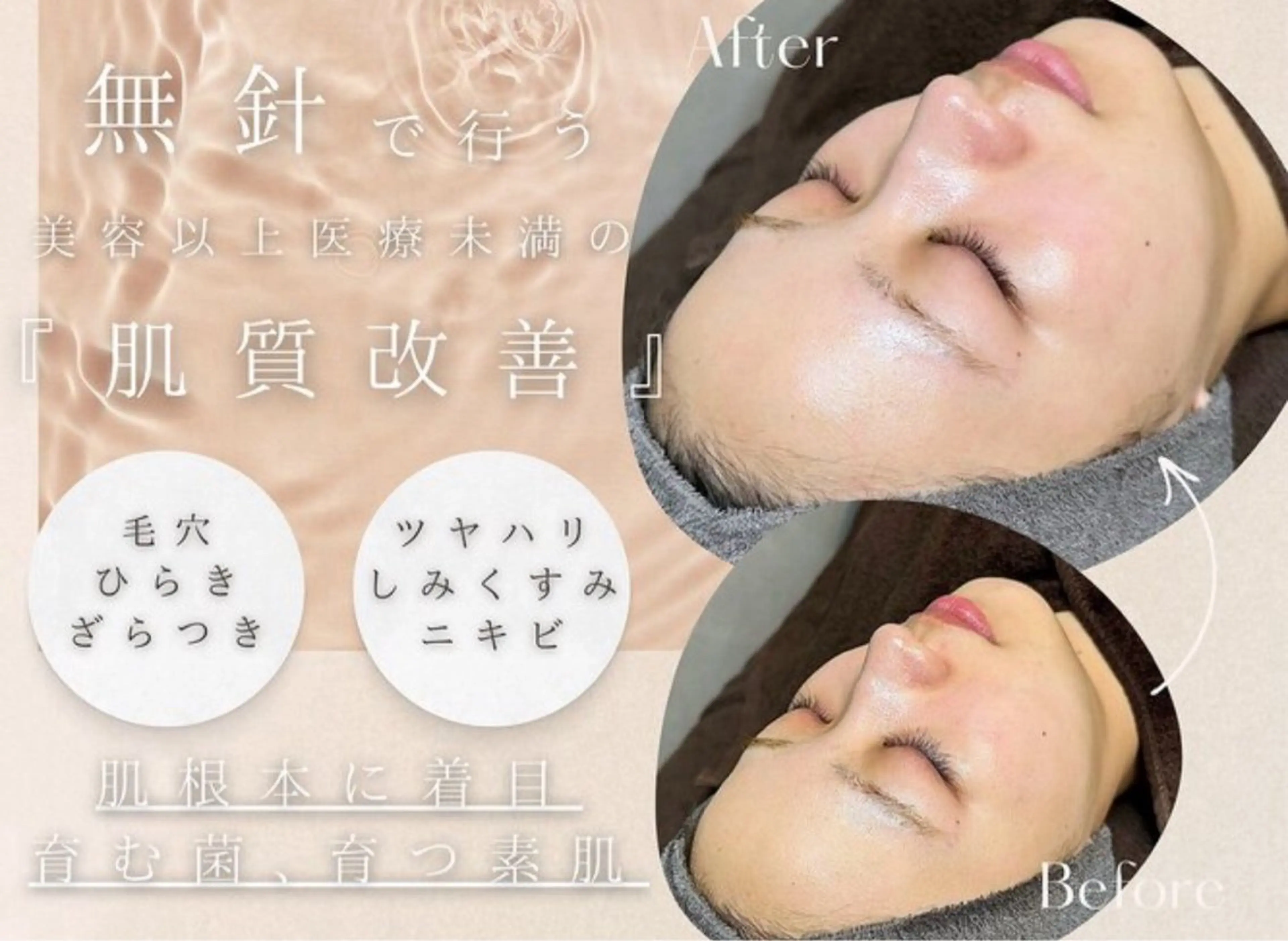 REMENTE池袋東口店所属・REMENTE🪞 KANAのエステ・リラクイメージ