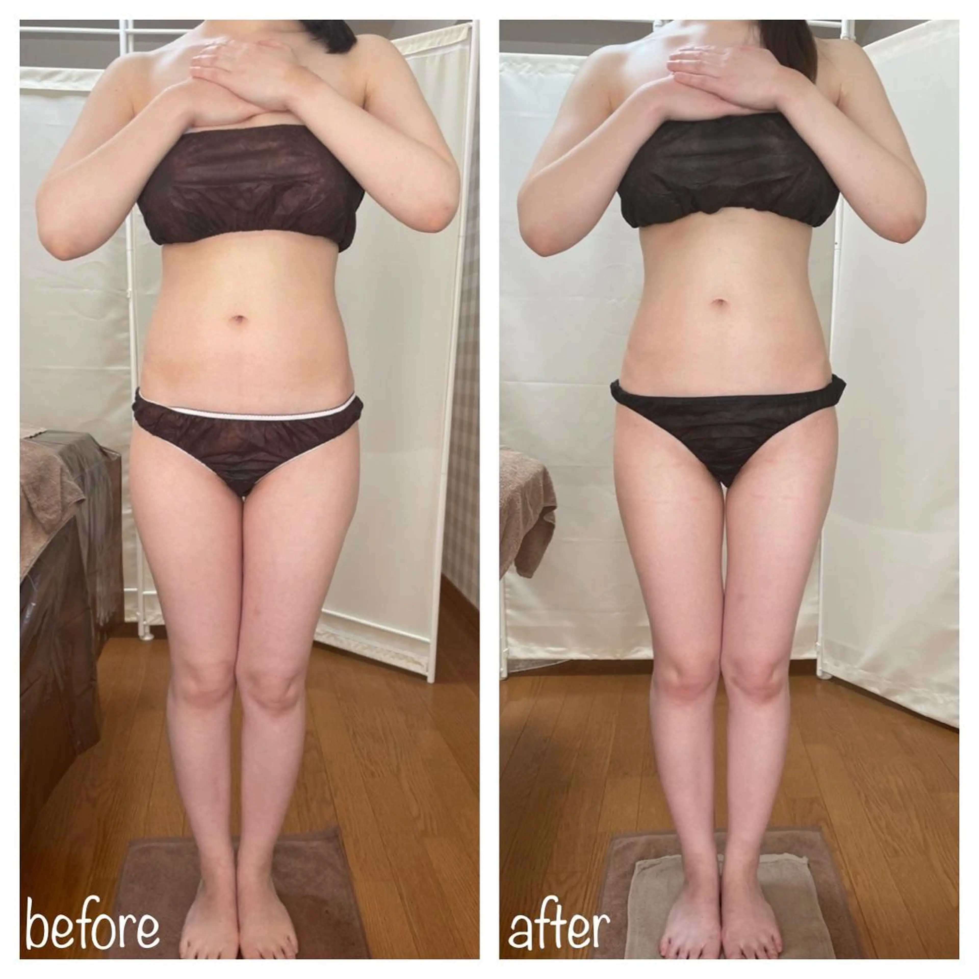 biloop所属・《痩身×疲労改善》 BILOOPのエステ・リラクイメージ