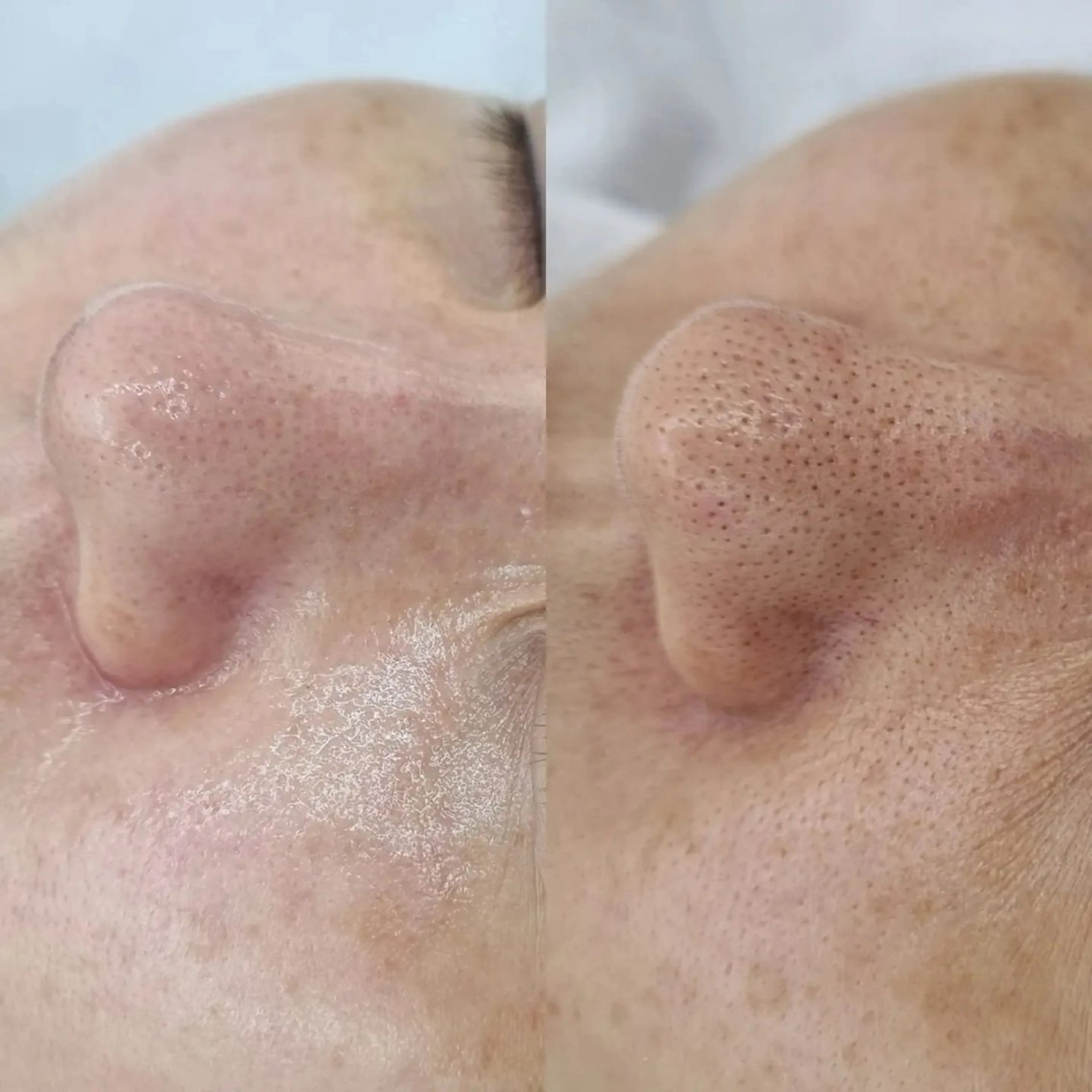 ＼オープン記念モニター募集💖／【おまかせ肌管理】肌状態に合わせてたあなただけのスペシャルコース💆‍♀️✨の写真