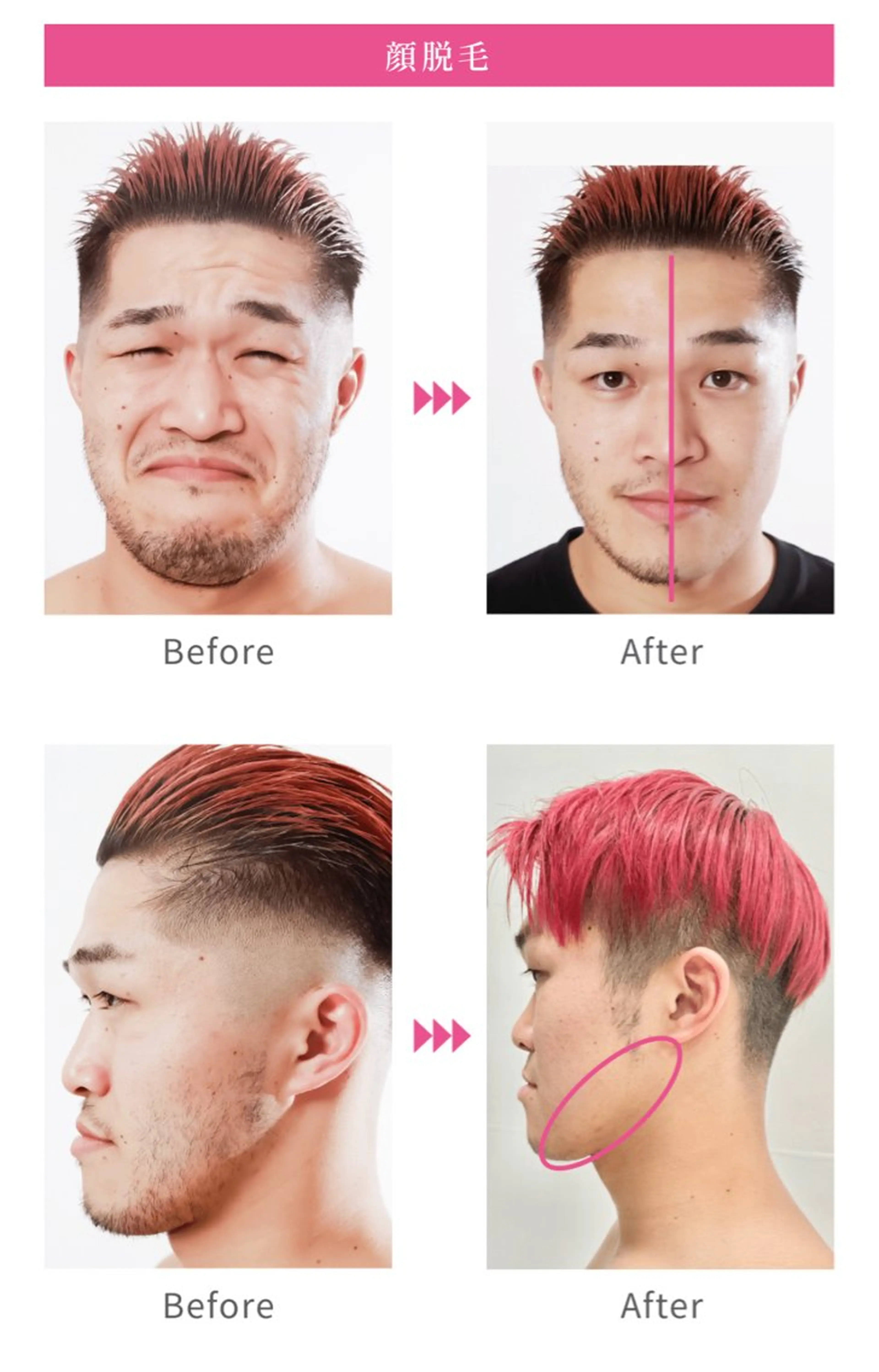 脱毛 Suteki肌＋所属・Suteki肌プラス 大田のエステ・リラクイメージ