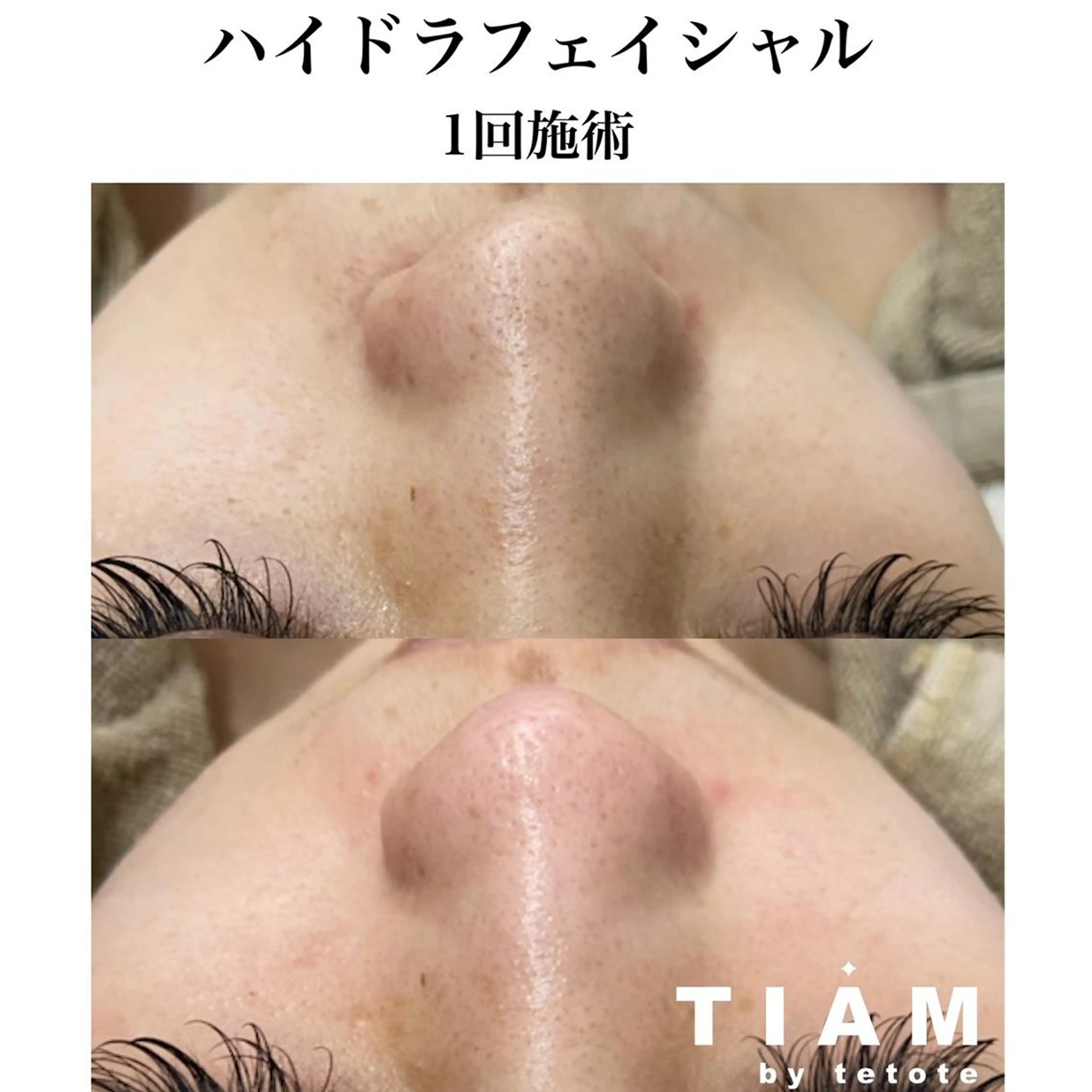 美肌サロンTIAM by tetoteのエステ・リラクイメージ