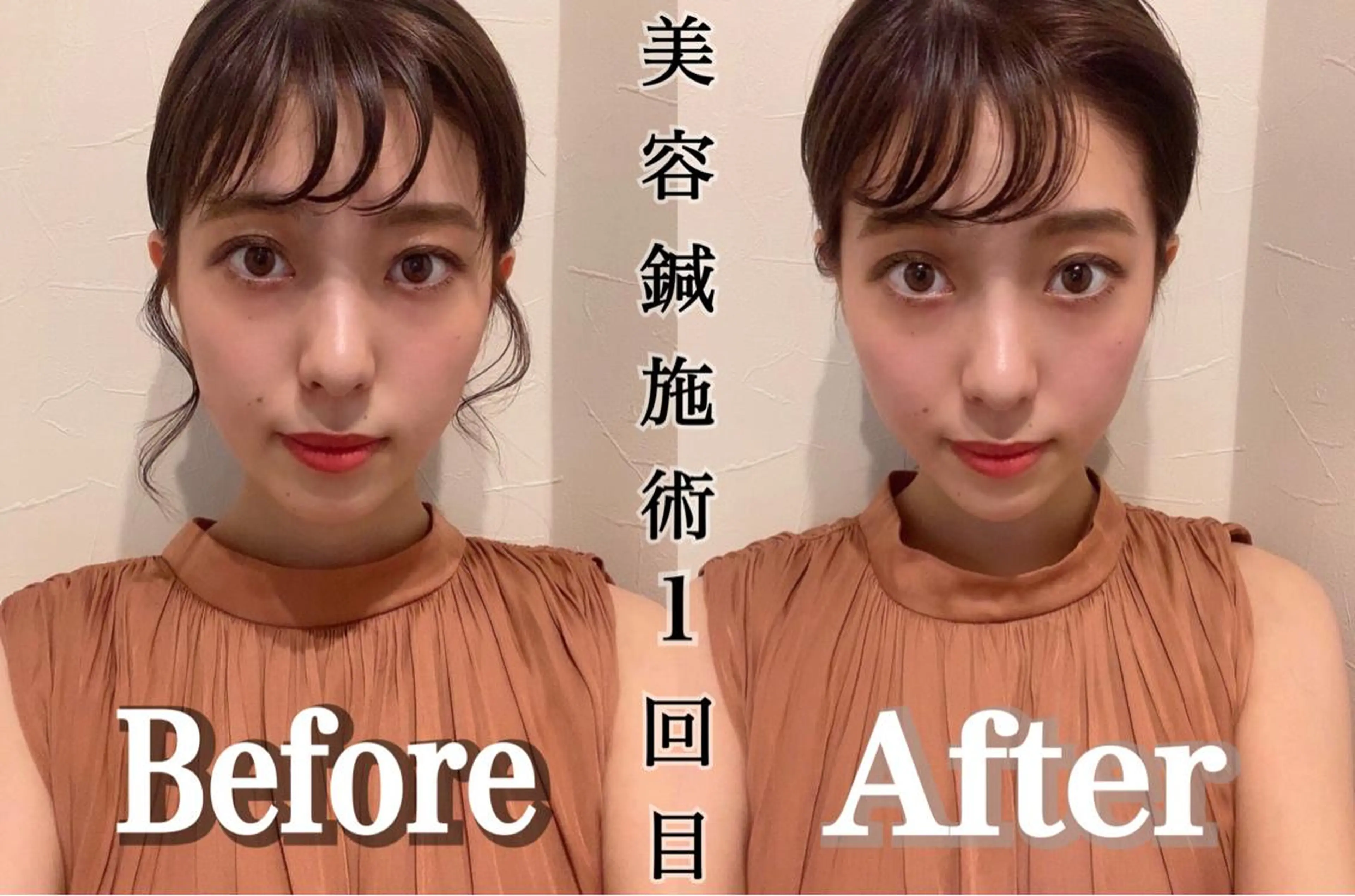 鍼灸整骨院Refine所属・鍼灸 Refineのその他イメージ