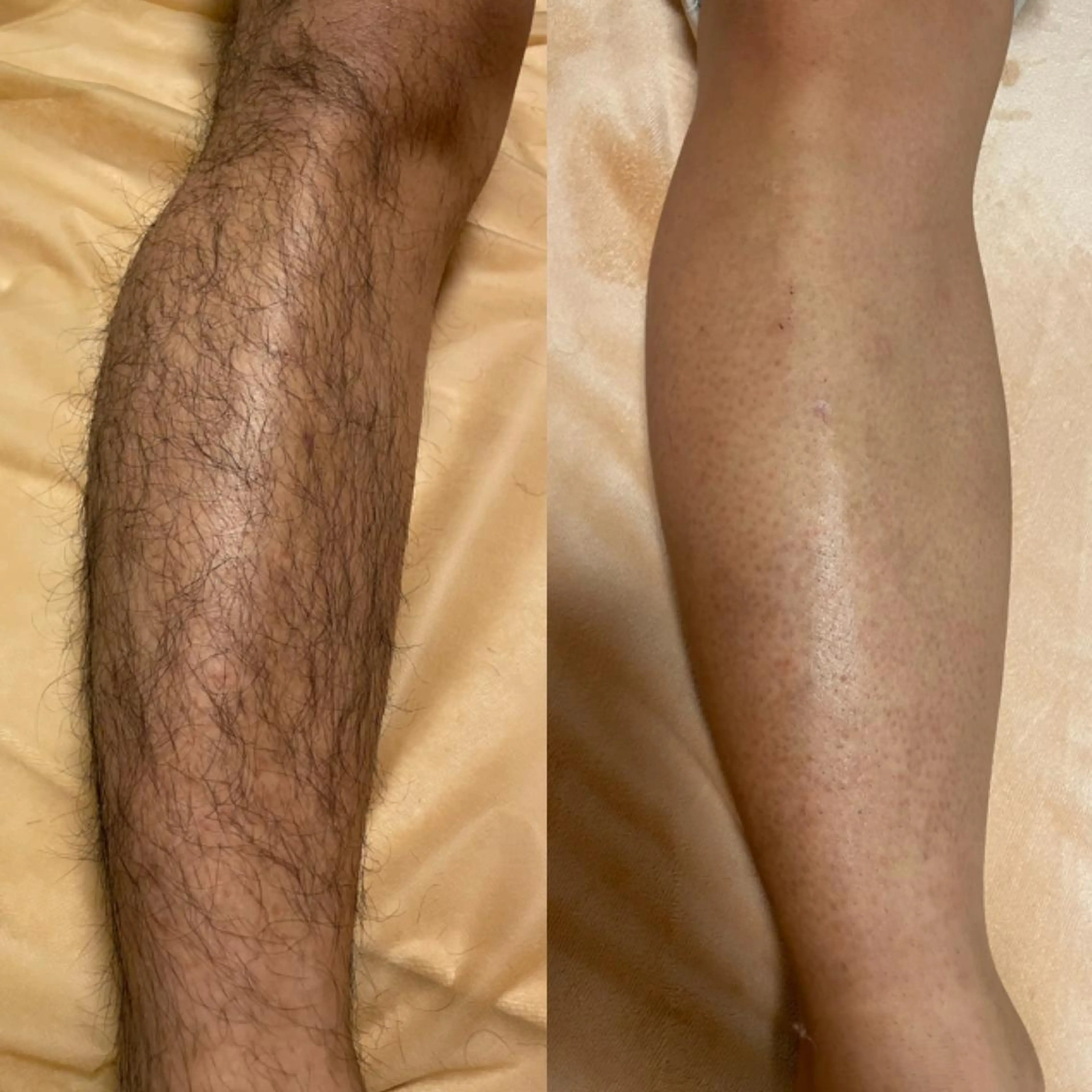 calimelo所属・calimero 美肌脱毛サロンの眉毛・アイブロウイメージ