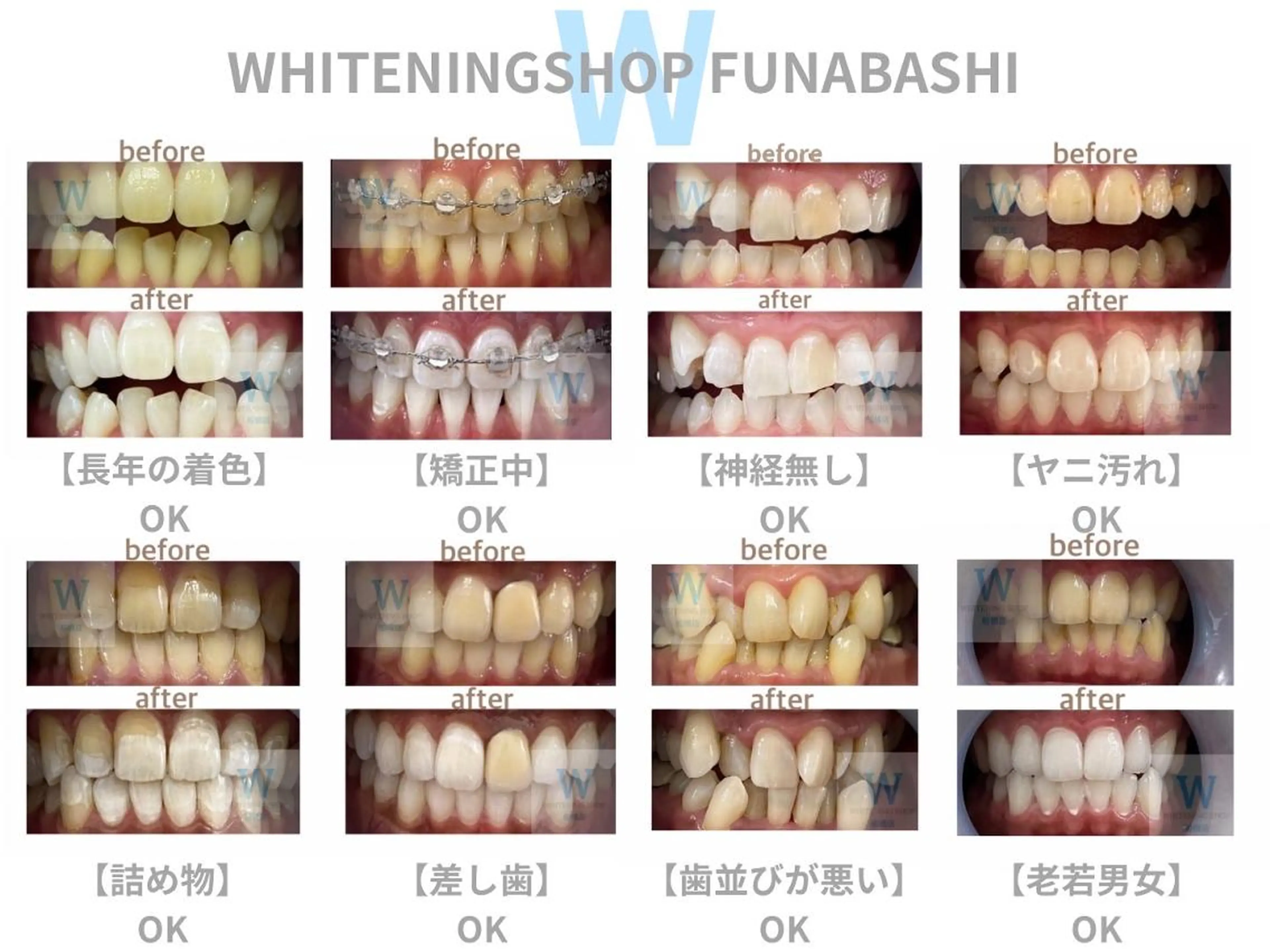 メンズ ホワイトニング ショップ本八幡店のエステ・リラクイメージ