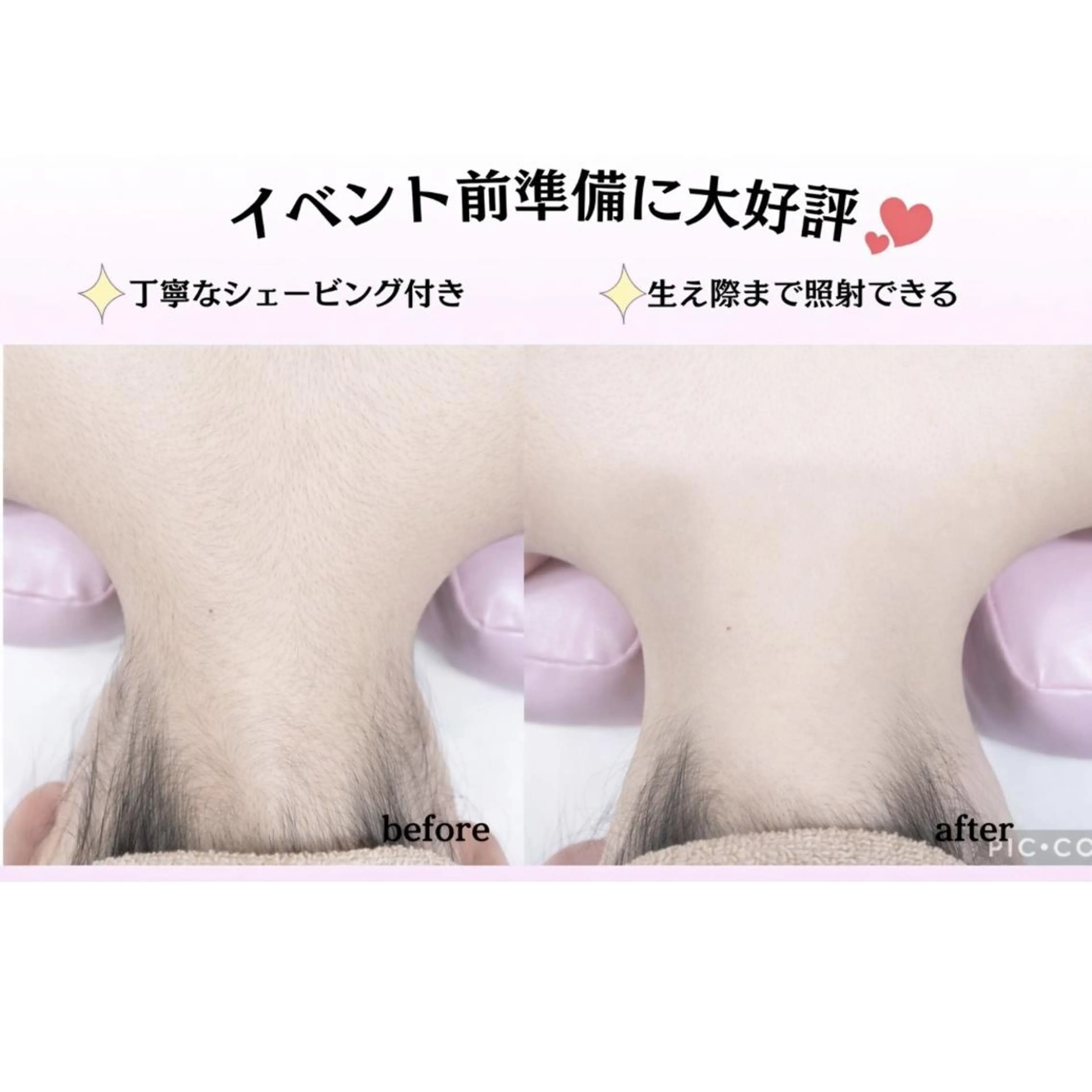 脱毛 🎀美肌サロン レイビス川崎店🎀のエステ・リラクイメージ