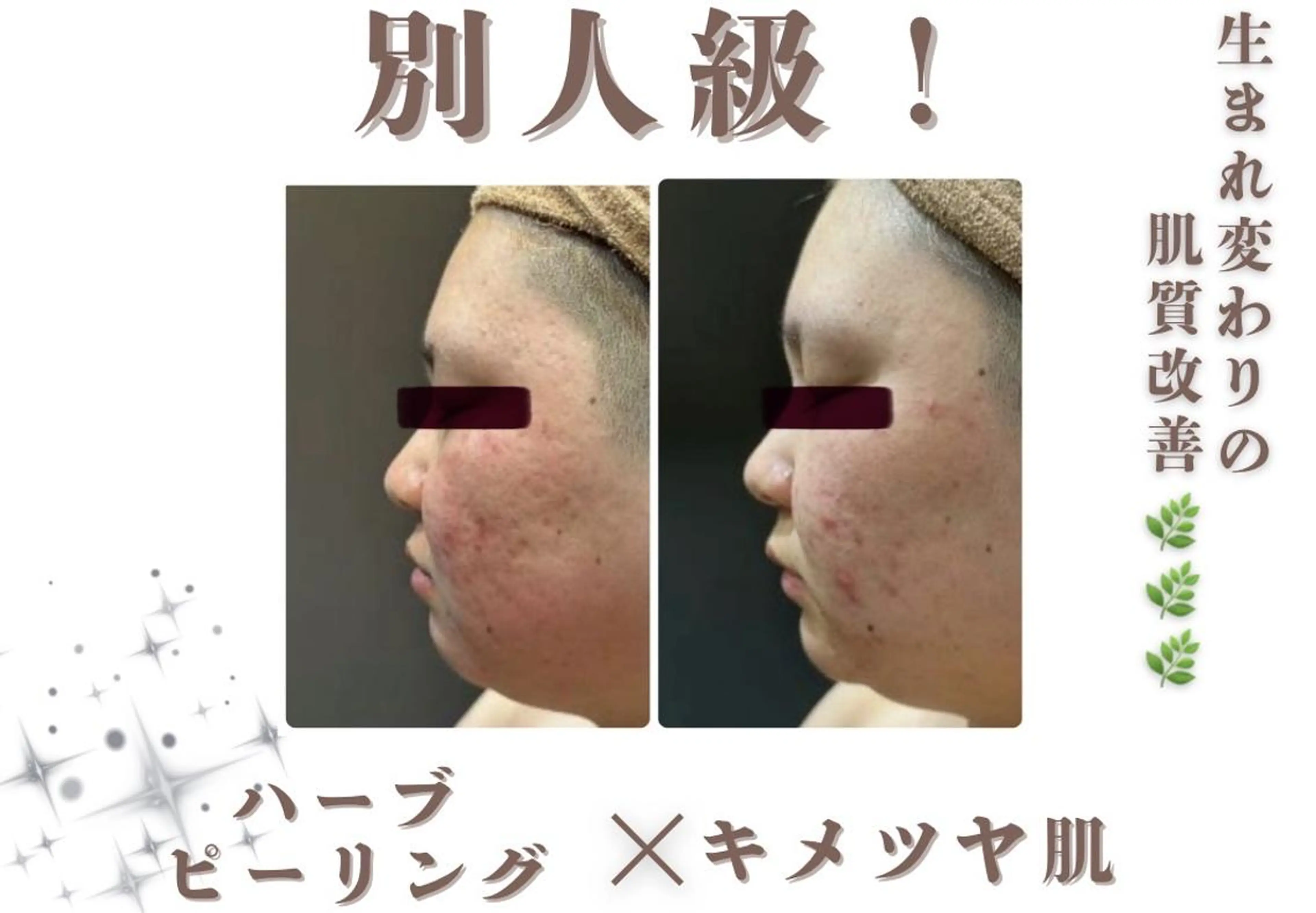 エステ 創業40周年✨美肌サ ロンRAYVIS銀座のエステ・リラクイメージ