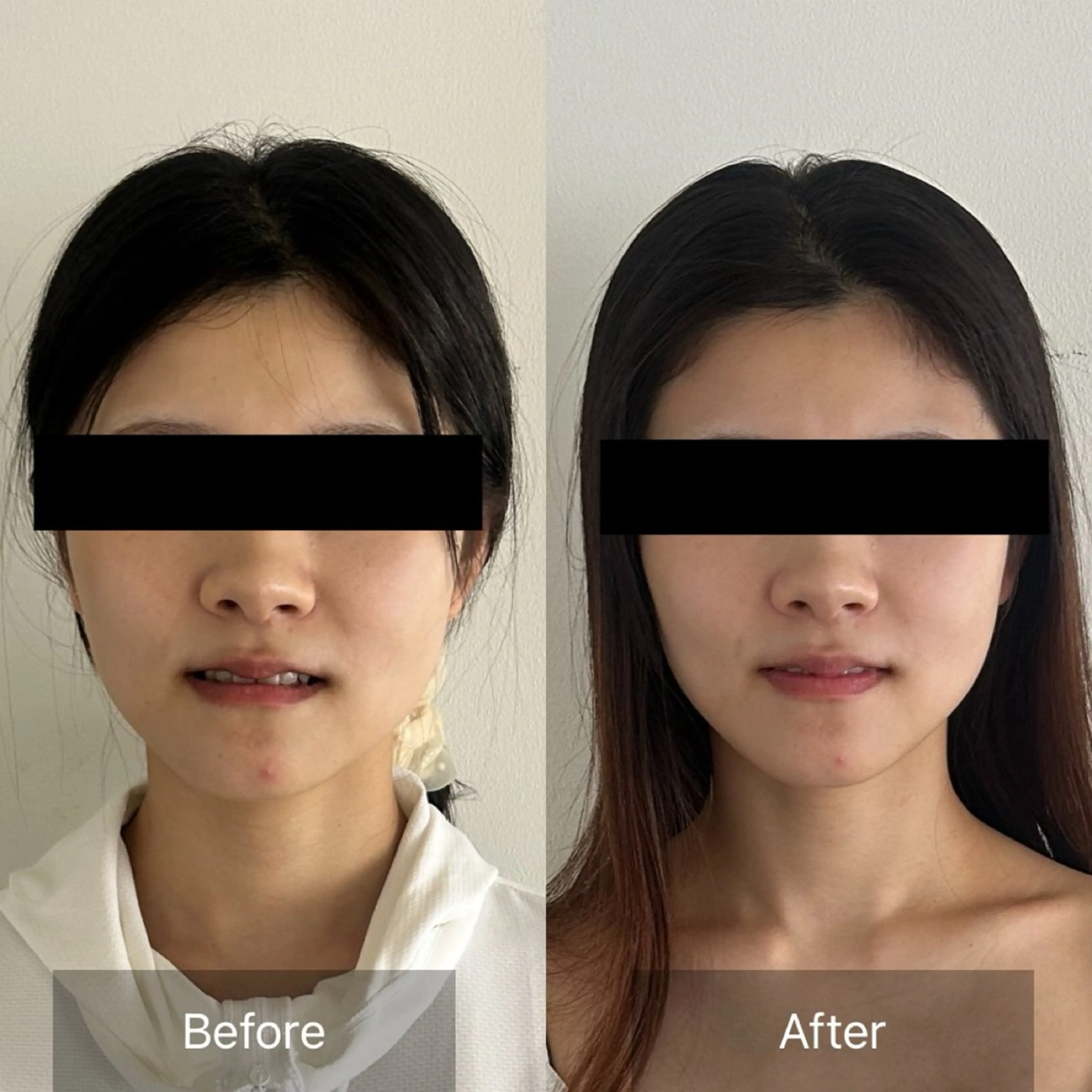 エステ リラク Radiance H.Oのエステ・リラクイメージ