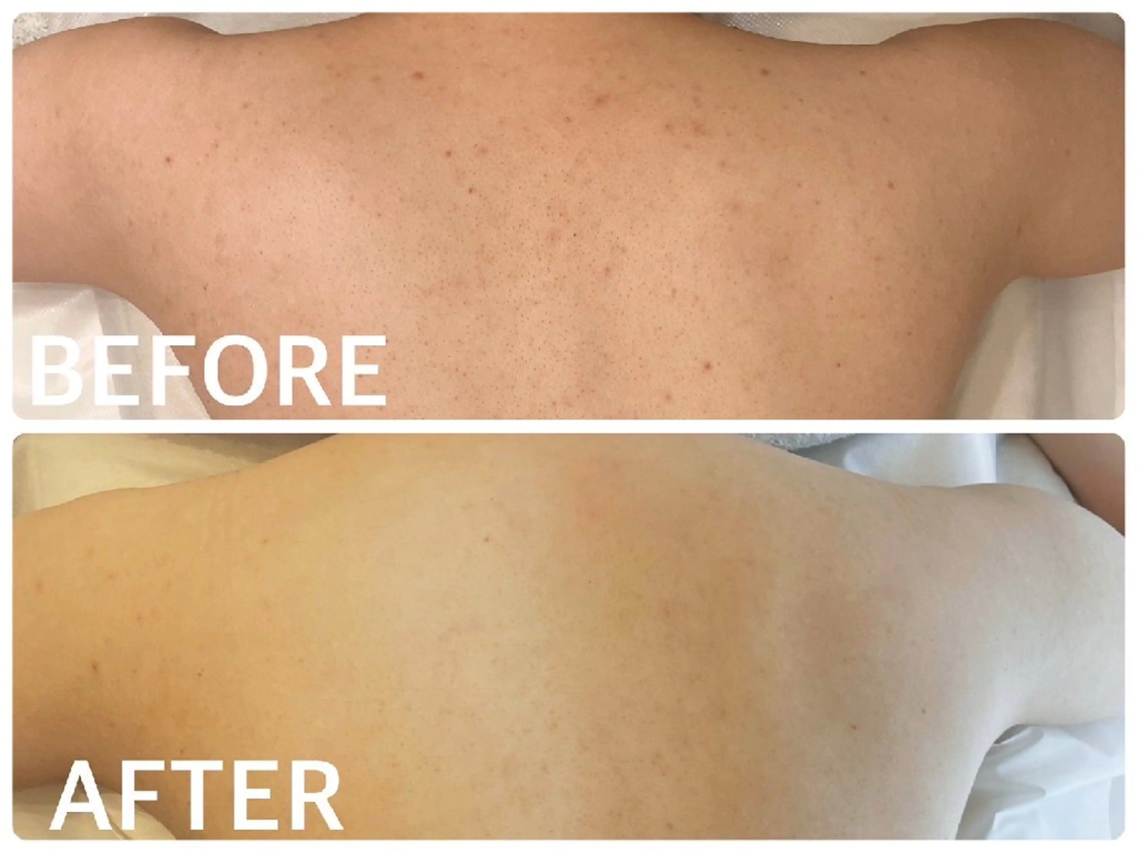 ハーブピーリング横浜 肌質改善専門店のその他イメージ