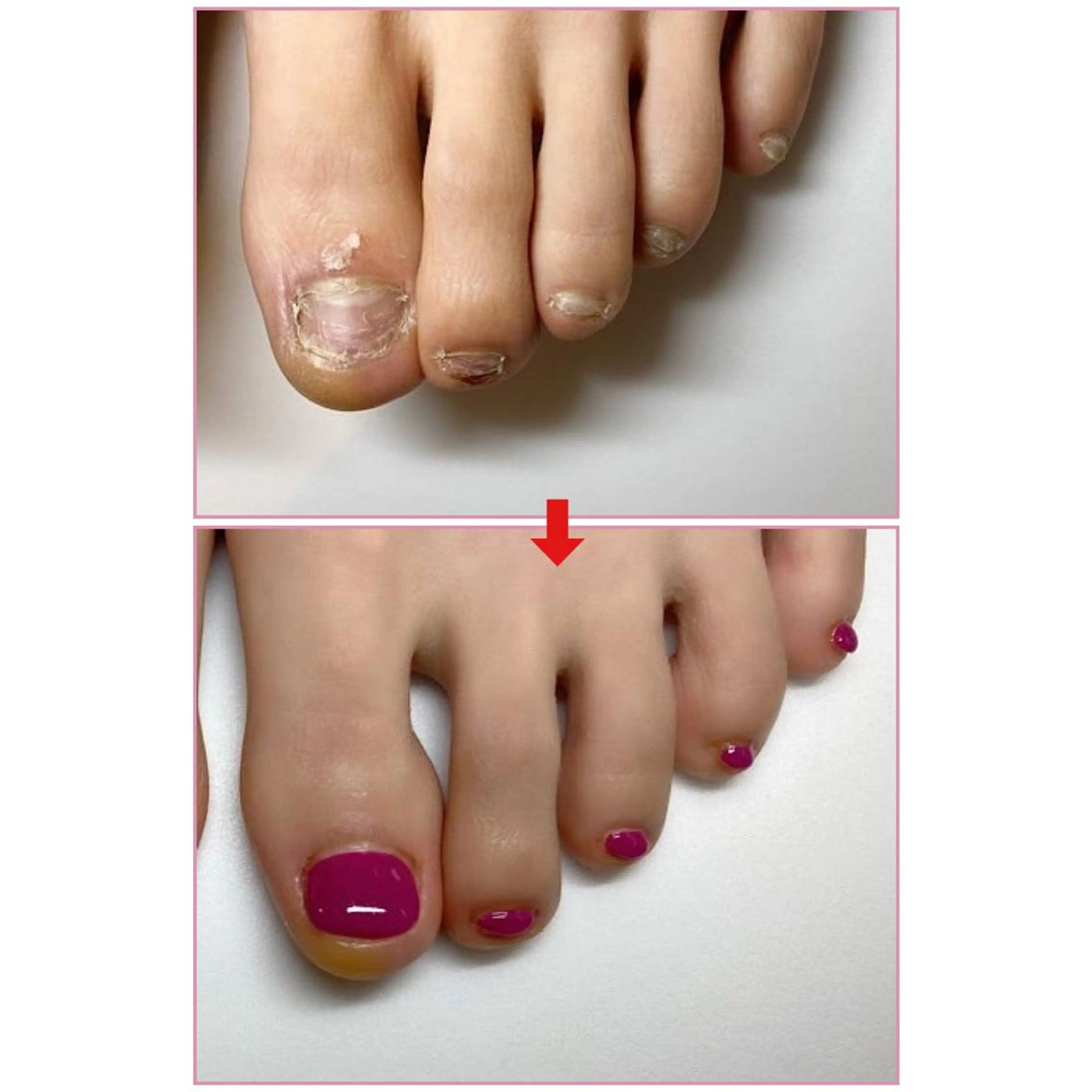 ネイル フットネイル ネイルサロンアリューム所属・ネイルサロン アリュームのネイルデザイン