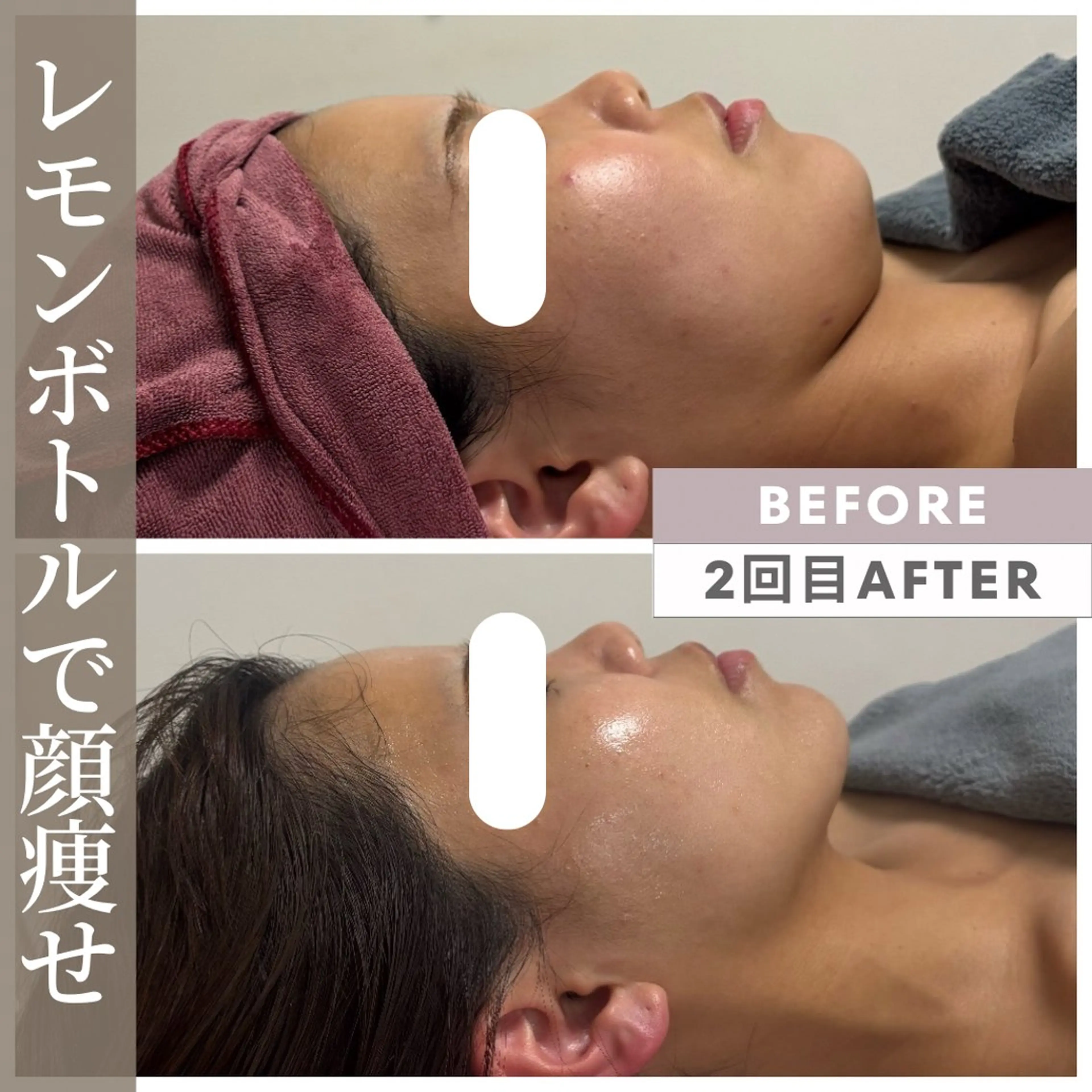 エステ リラク 小顔矯正専門店 【RED】池田のエステ・リラクイメージ